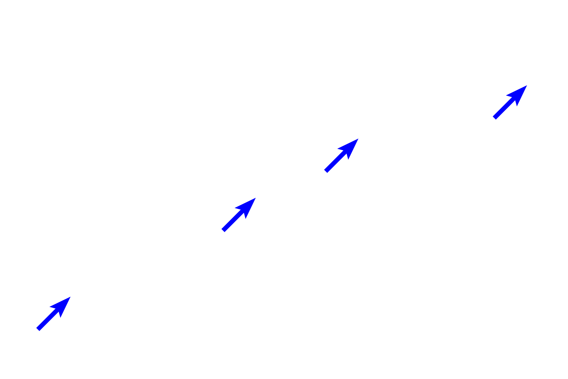  - Dermal papillae  <p>The papillary layer of the dermis, composed of loose connective tissue, forms an undulating interface with the overlying epidermis.  At this junction, dermal papillae alternate with epidermal ridges or pegs (rete ridges or pegs) projecting downward from the epidermis.  The thicker reticular layer of dermis is composed of dense irregular connective tissue.  200x</p>

