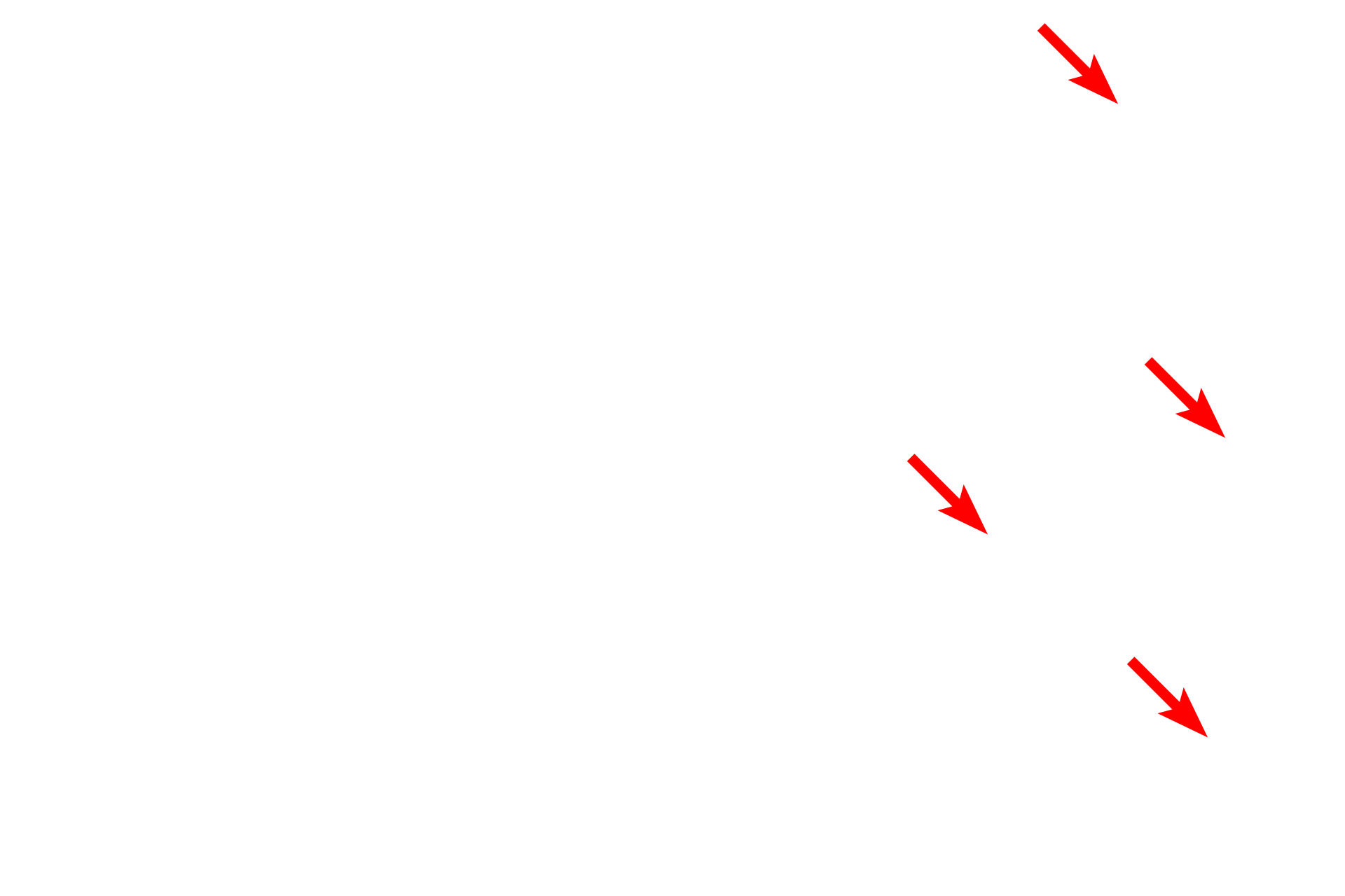 Collagen bundles <p>The narrow papillary layer of the dermis is highly vascular and contains finer caliber collagen fibers and more cells than the reticular layer.  Thicker collagen bundles predominate in the reticular layer.  The darkly-stained elastic fibers interlace with the collagen; together they provide the dermis with elasticity and strength, respectively. Toluidine blue stain, 1000x</p>
