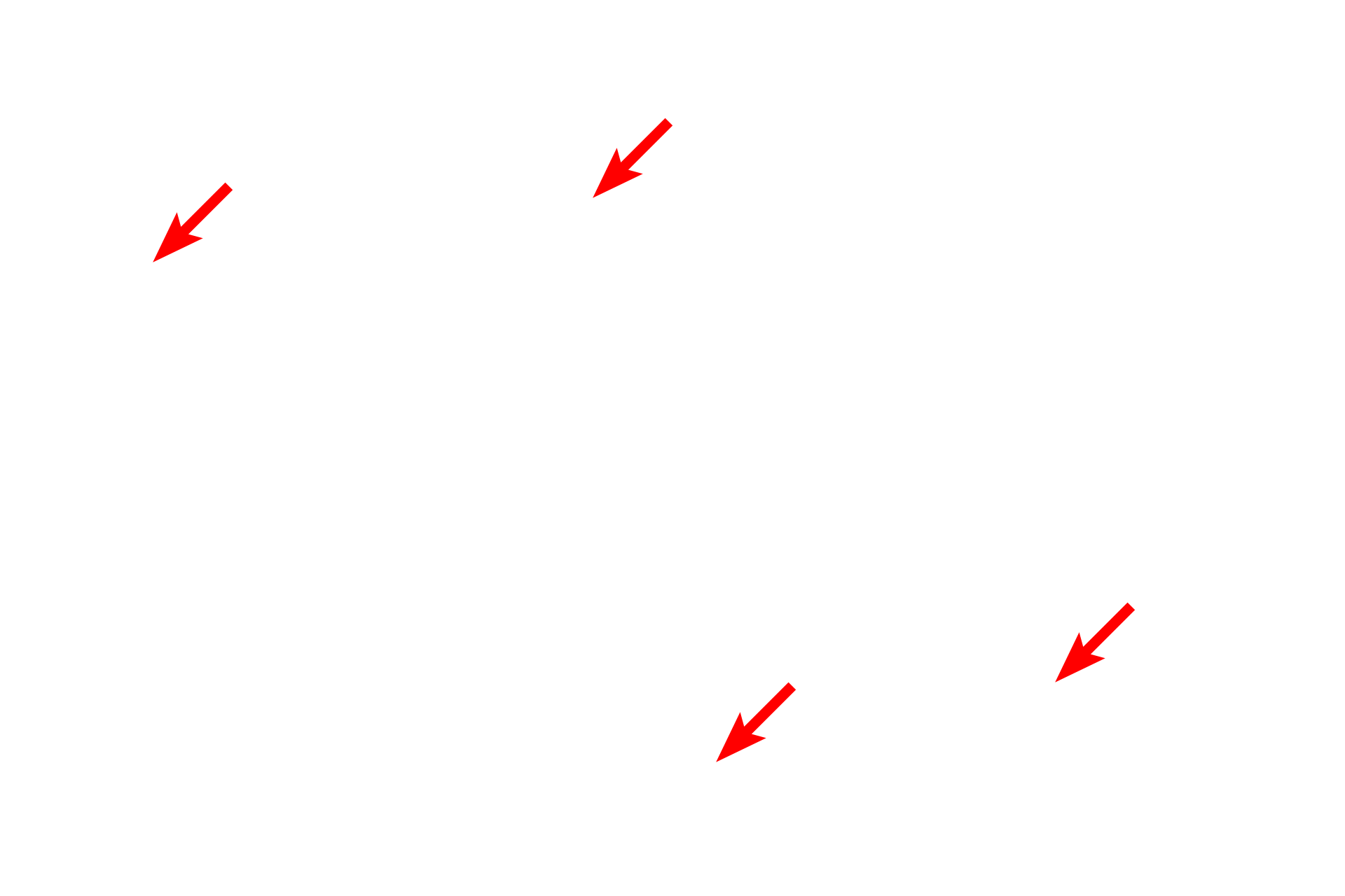 Elastic fibers <p>The pentachrome stain also demonstrates the elastic fiber content of the dermis.  These fibers, which stain purple or black, permit stretch and recoil in the dermis.  Collagen bundles are thicker and stain yellow-green. Pentachrome stain, 400x</p>

