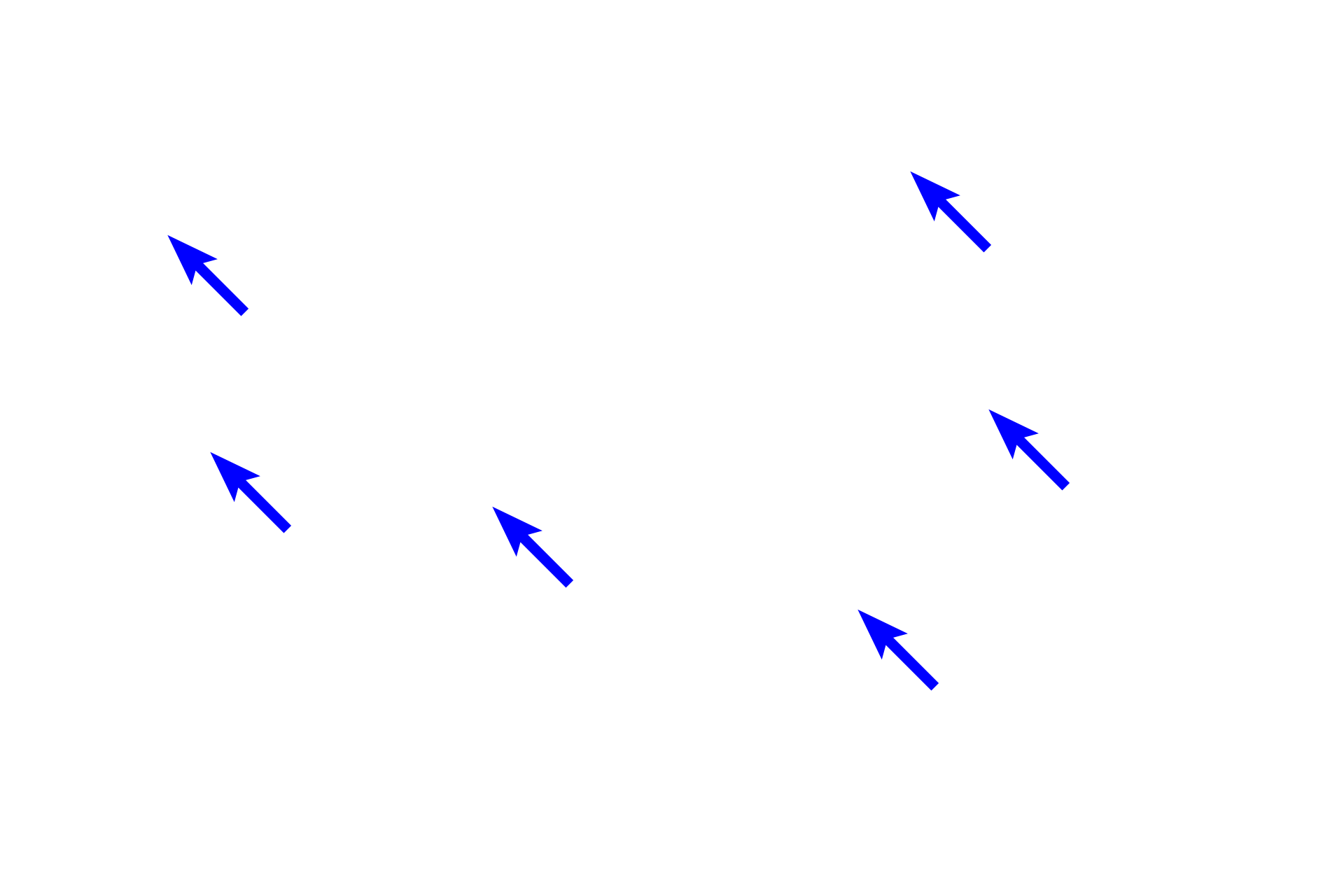 Elastic fibers <p>Elastic fibers can sometimes be identified with eosin; however, in most cases, a special elastin stain is required. These images of dense irregular connective tissue in the reticular layer contrast the appearance of elastic fibers using different staining techniques. 200x, 200x</p>
