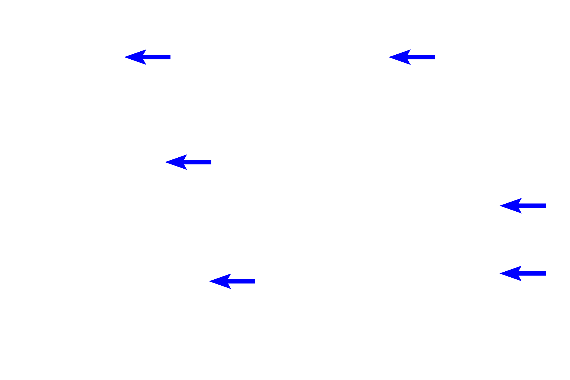 Collagen fibers <p>Elastic fibers can sometimes be identified with eosin; however, in most cases, a special elastin stain is required. These images of dense irregular connective tissue in the reticular layer contrast the appearance of elastic fibers using different staining techniques. 200x, 200x</p>
