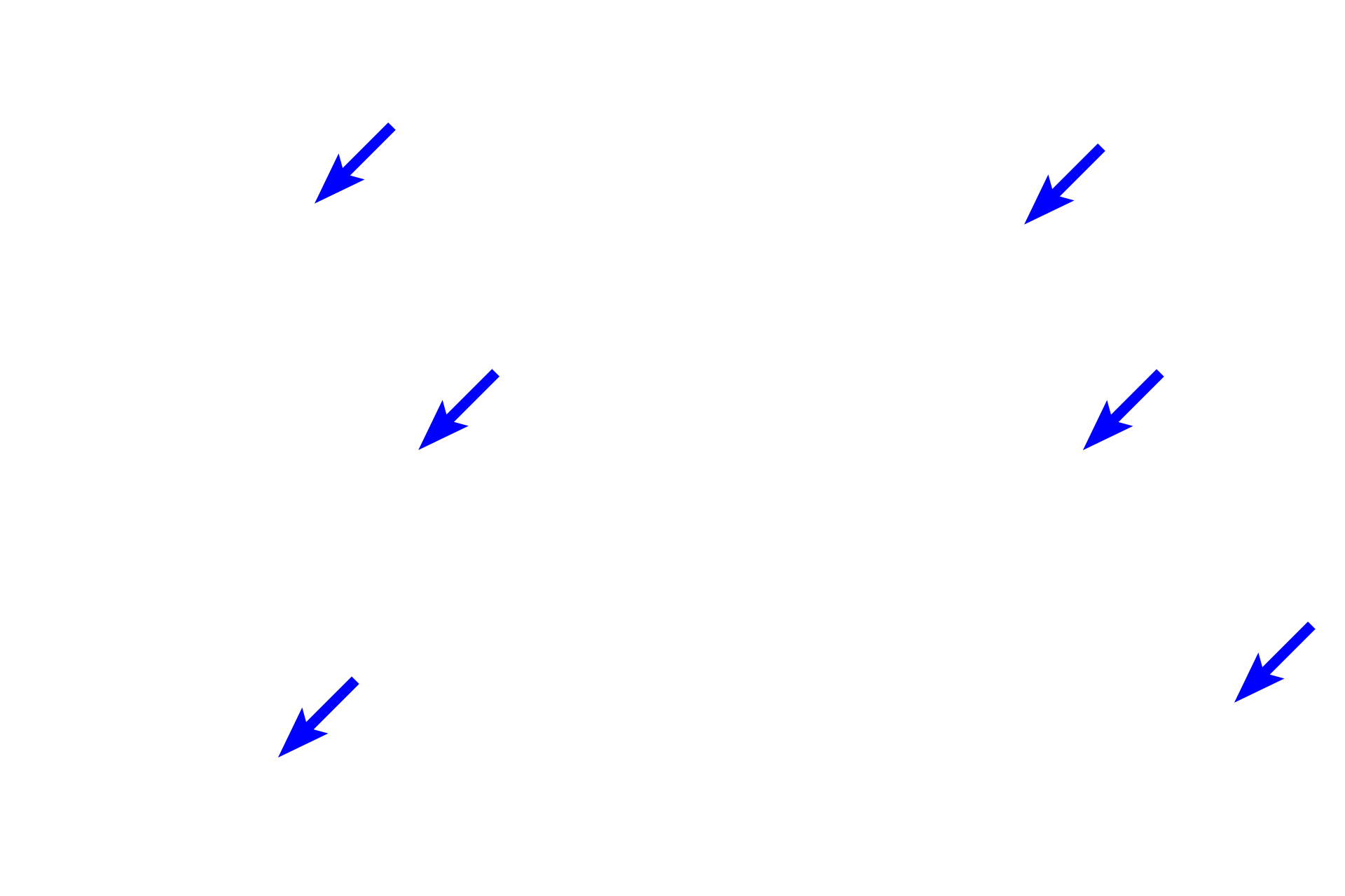 Ground substance <p>Elastic fibers can sometimes be identified with eosin; however, in most cases, a special elastin stain is required. These images of dense irregular connective tissue in the reticular layer contrast the appearance of elastic fibers using different staining techniques. 200x, 200x</p>

