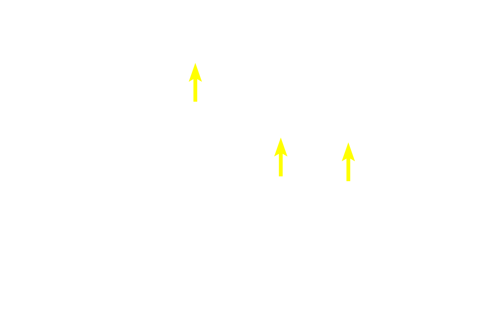  - Tonofibrils <p>Stratum spinosum contains 3-10 layers of polygonal keratinocytes with euchromatic nuclei. These cells possess prominent tonofibrils, bundles of intermediate filaments (tonofilaments) composed of keratin protein.  Adjacent keratinocytes are attached by numerous desmosomes, creating the spiny appearance around their periphery. 200x, 1,500x</p>
