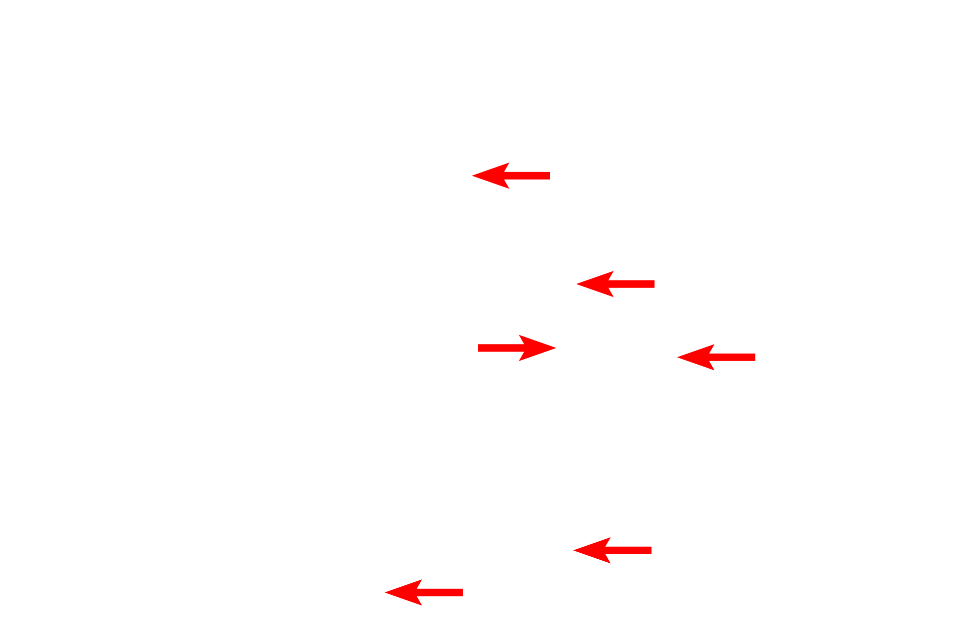 Tonofibrils <p>Keratinocytes of stratum spinosum are firmly attached to each other by numerous desmosomes, which anchor the cells against physical abrasion. Desmosomes are associated with large numbers of tonofibrils that extend into the cytoplasm. The presence of these desmosomes produces the spiny appearance of stratum spinosum.  6000x</p>
