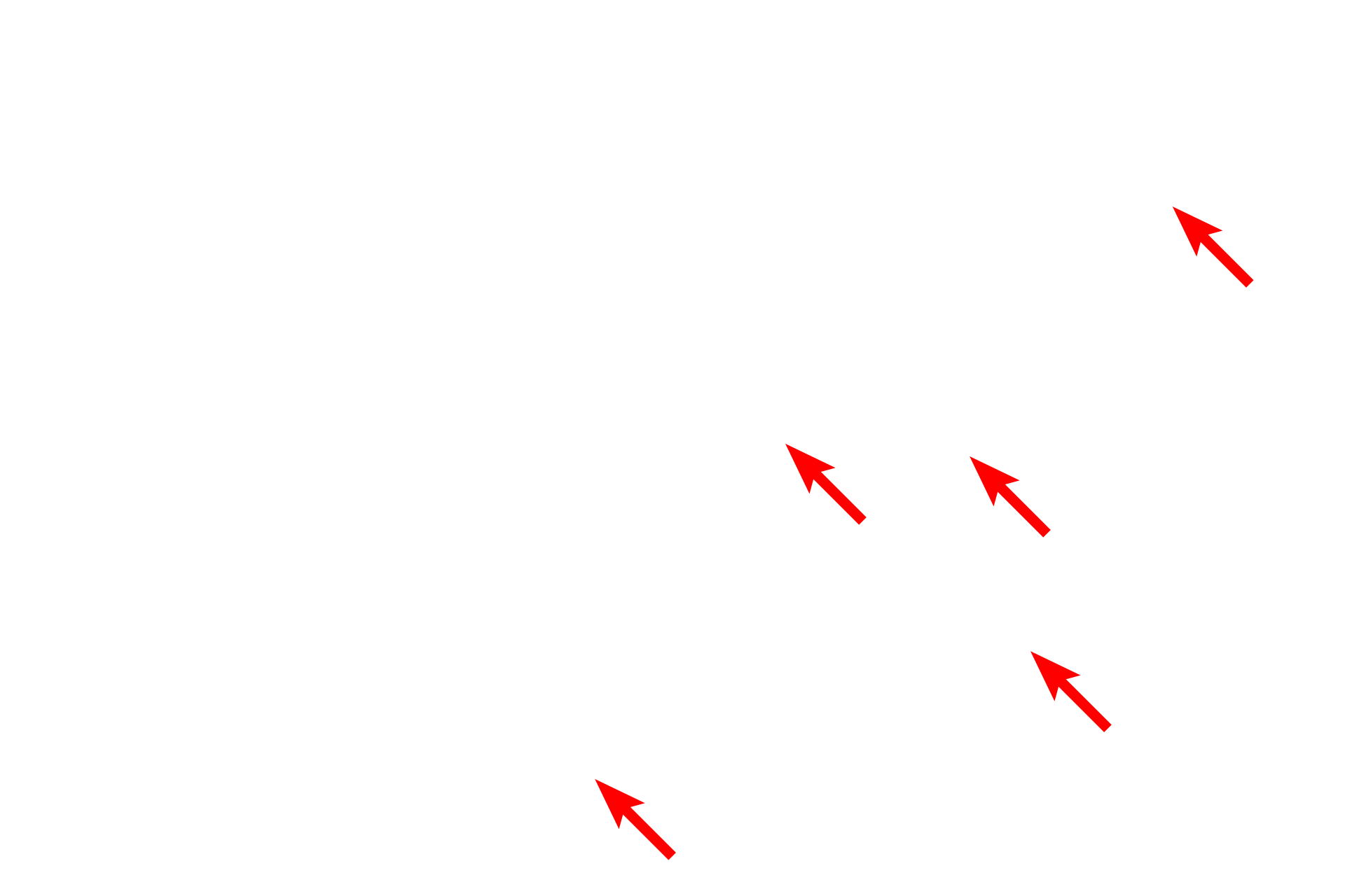 Desmosomes <p>Keratinocytes of stratum spinosum are firmly attached to each other by numerous desmosomes, which anchor the cells against physical abrasion. Desmosomes are associated with large numbers of tonofibrils that extend into the cytoplasm. The presence of these desmosomes produces the spiny appearance of stratum spinosum.  6000x</p>
