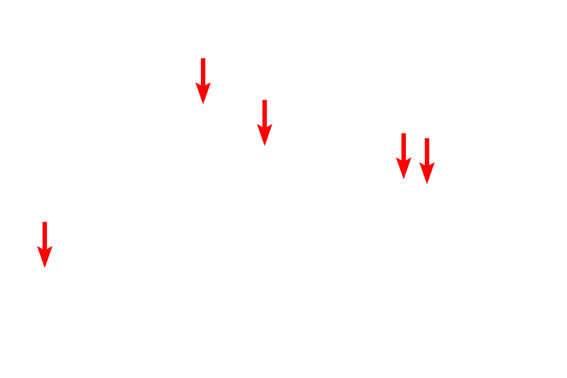 Plasma membrane <p>Keratinocytes of stratum spinosum are firmly attached to each other by numerous desmosomes, which anchor the cells against physical abrasion. Desmosomes are associated with large numbers of tonofibrils that extend into the cytoplasm. The presence of these desmosomes produces the spiny appearance of stratum spinosum.  6000x</p>

