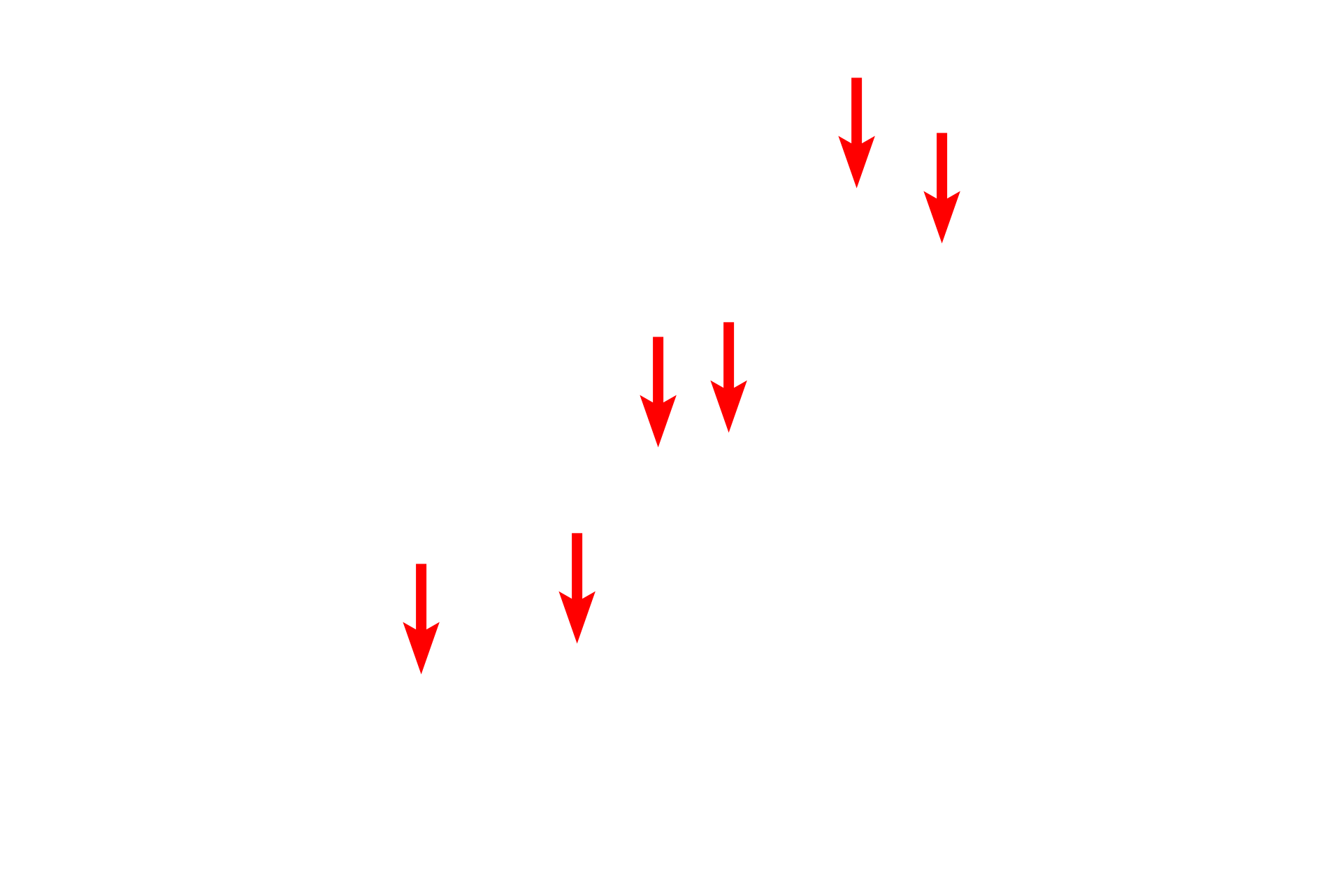  - Attachment plaques <p>Desmosomes are adherent junctions consisting of an electron-dense, proteinaceous attachment plaque into which keratin filaments insert. Proteins extend from the plaque into the intercellular space, where they overlap and provide the attachment between the cells. 70,000x</p>

