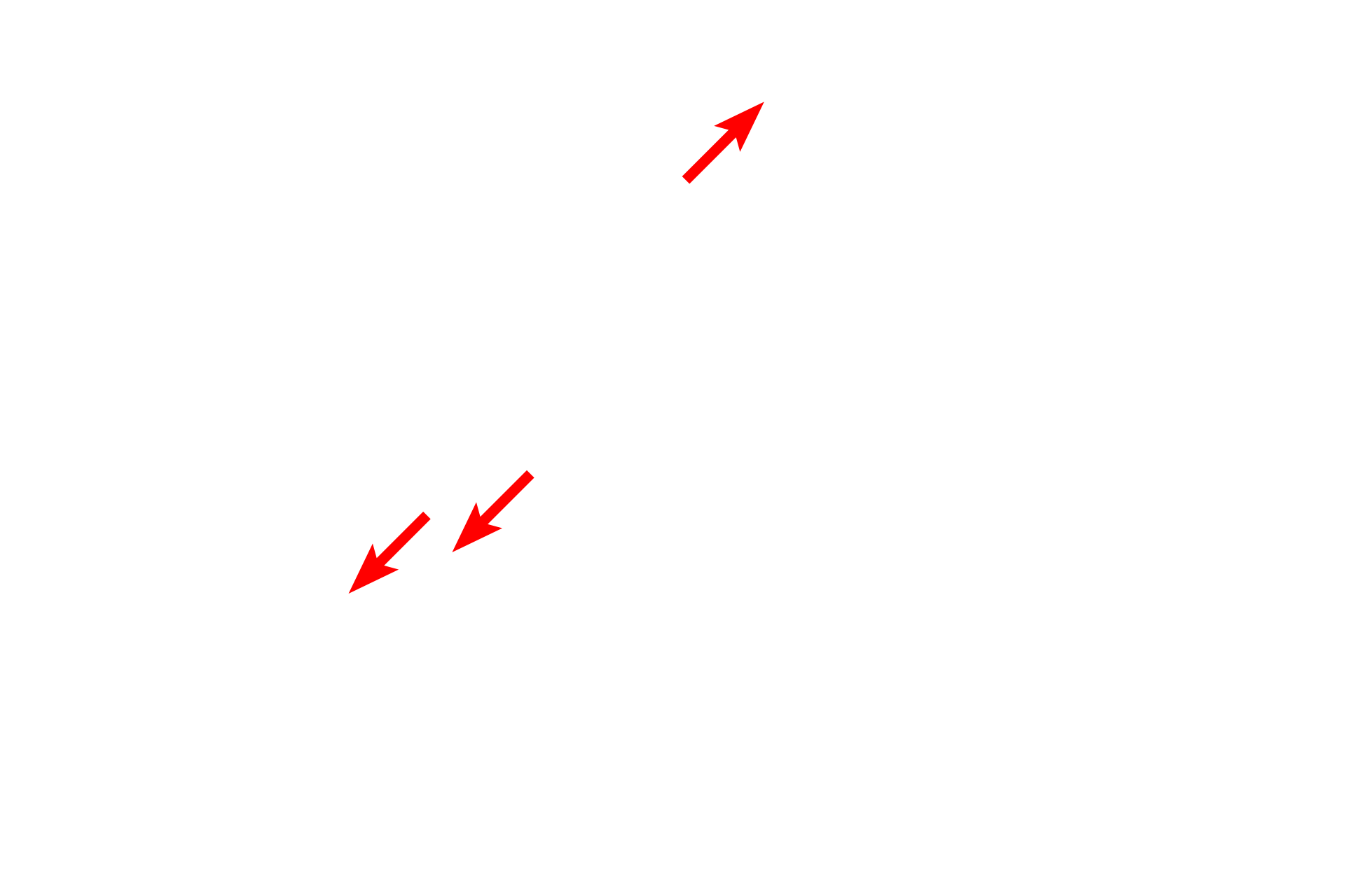  - Keratin filaments <p>Desmosomes are adherent junctions consisting of an electron-dense, proteinaceous attachment plaque into which keratin filaments insert. Proteins extend from the plaque into the intercellular space, where they overlap and provide the attachment between the cells. 70,000x</p>
