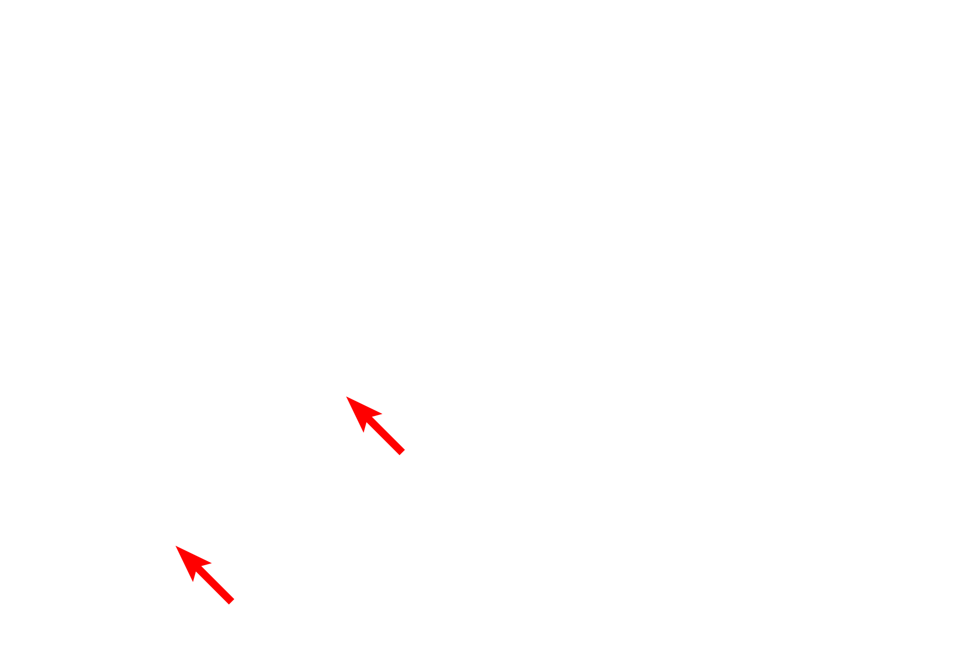  - Langerhans cell <p>This electron micrograph shows the upper portion of the stratum spinosum, the stratum granulosum and the stratum corneum.  Also visible is a Langerhans cell, a dendritic macrophage functioning in local immune responses.  Cells of the stratum spinosum synthesize lamellar bodies as well as the components of keratohyalin granules.  Small to medium-sized keratohyalin granules are visible in the stratum granulosum just beneath the stratum corneum.  4000x</p>
