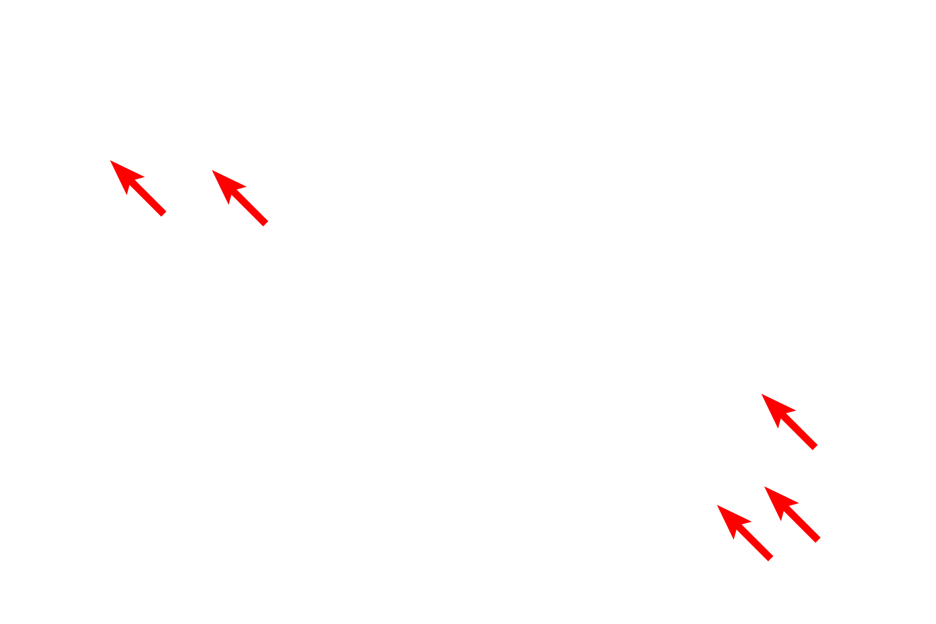  - Desmosomes <p>This electron micrograph shows the upper portion of the stratum spinosum, the stratum granulosum and the stratum corneum.  Also visible is a Langerhans cell, a dendritic macrophage functioning in local immune responses.  Cells of the stratum spinosum synthesize lamellar bodies as well as the components of keratohyalin granules.  Small to medium-sized keratohyalin granules are visible in the stratum granulosum just beneath the stratum corneum.  4000x</p>
