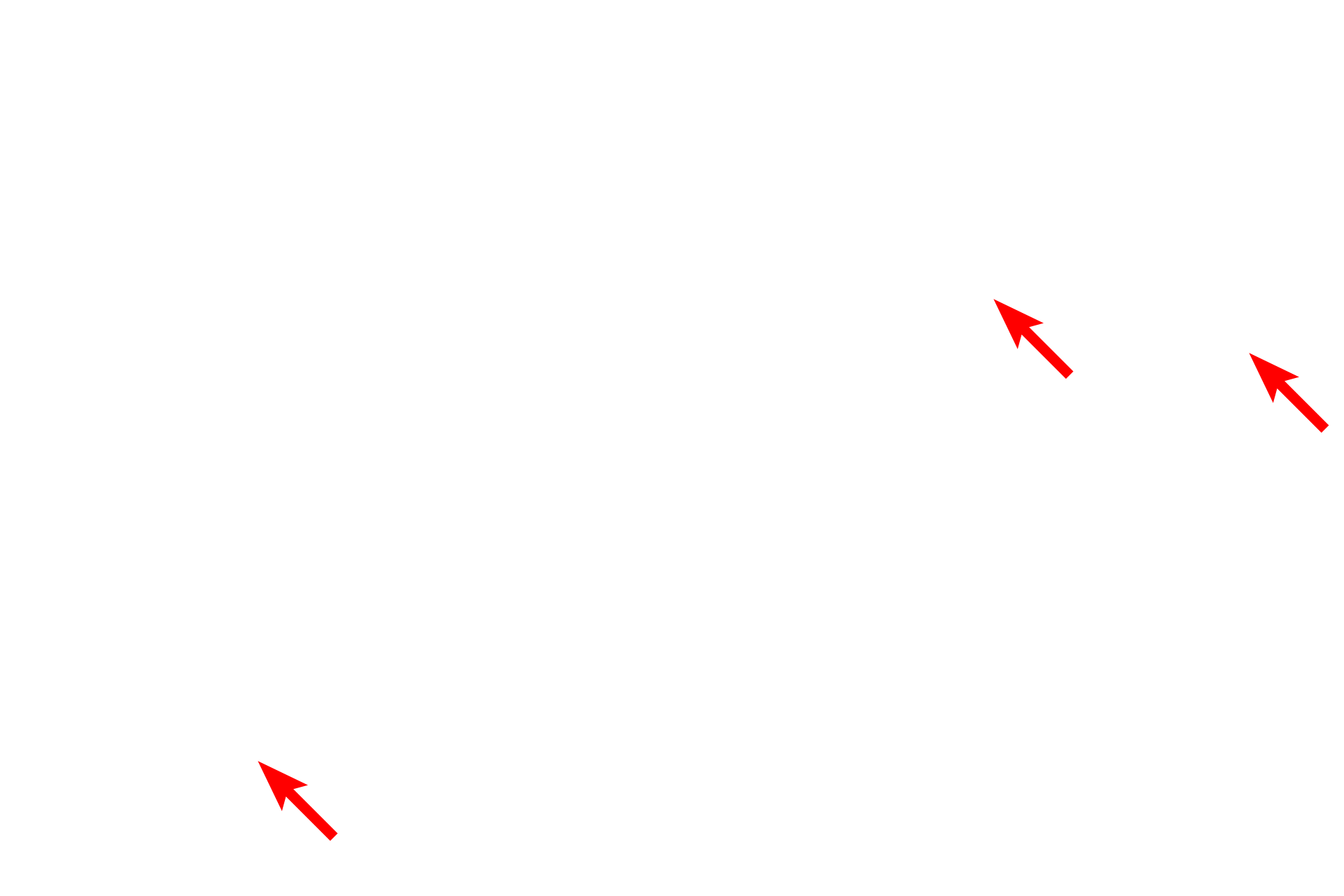  - Dendritic processes <p>Langerhans cells are migratory macrophages that are involved in skin immunosurveillance, antimicrobial immunity, and the induction phase of contact hypersensitivity.  They have an irregular nucleus, a clear cytoplasm and numerous tendril-like dendritic processes.  After phagocytosing antigens, Langerhans cells migrate out of the epidermis, eventually reaching lymph nodes to initiate an immune response.  Langerhans cells are most commonly seen in the stratum spinosum.  15,000x</p>
