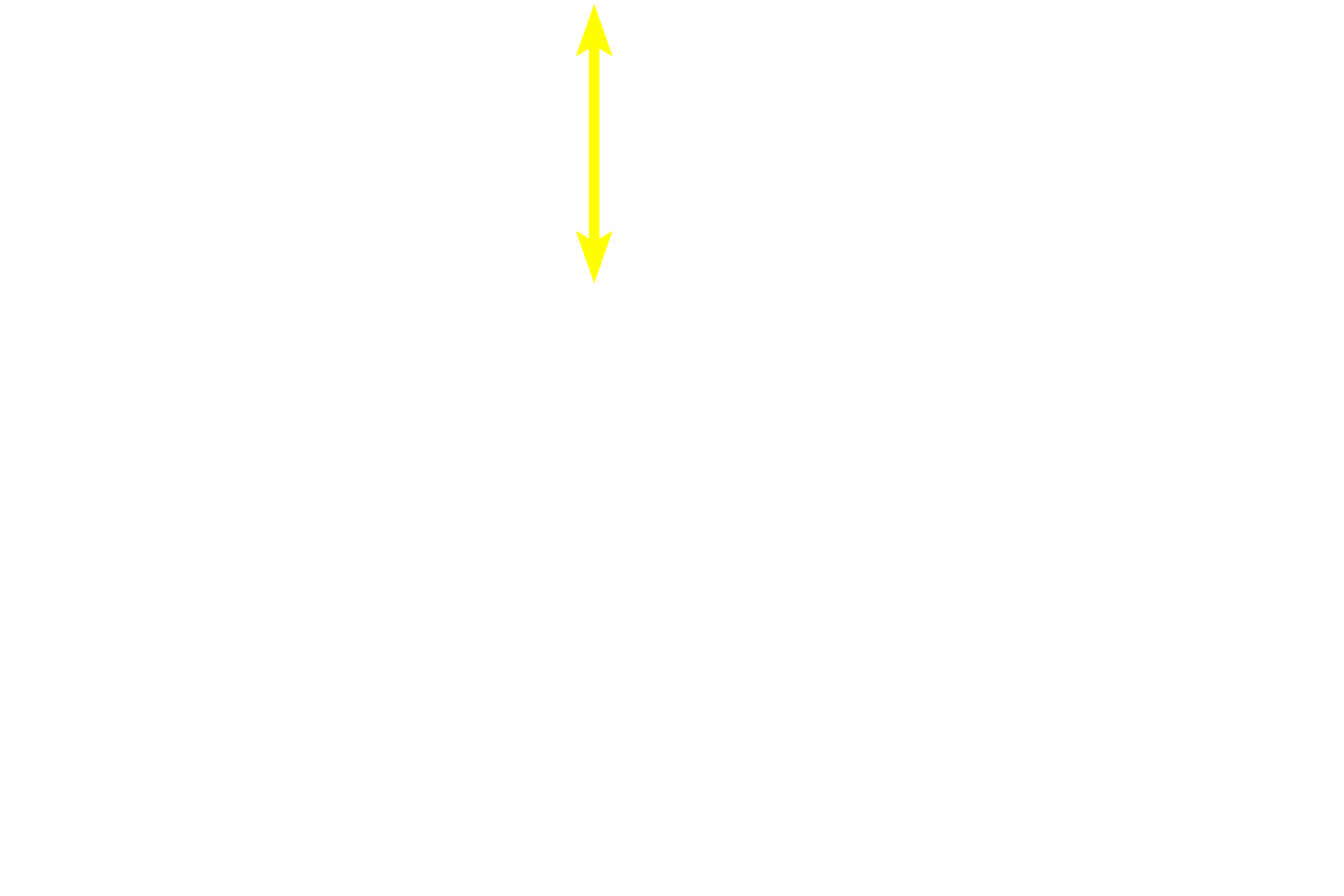 Stratum corneum > <p>As cells transition from the stratum granulosum to the stratum corneum, contents of the keratohyalin granules combine with tonofibrils to produce an aggregated matrix within the cell.  Additionally, subplasmalemmal proteins become cross-linked, resulting in a thickened, cornified cell envelope.  The resultant non-living scales or squames form the stratum corneum. </p>
