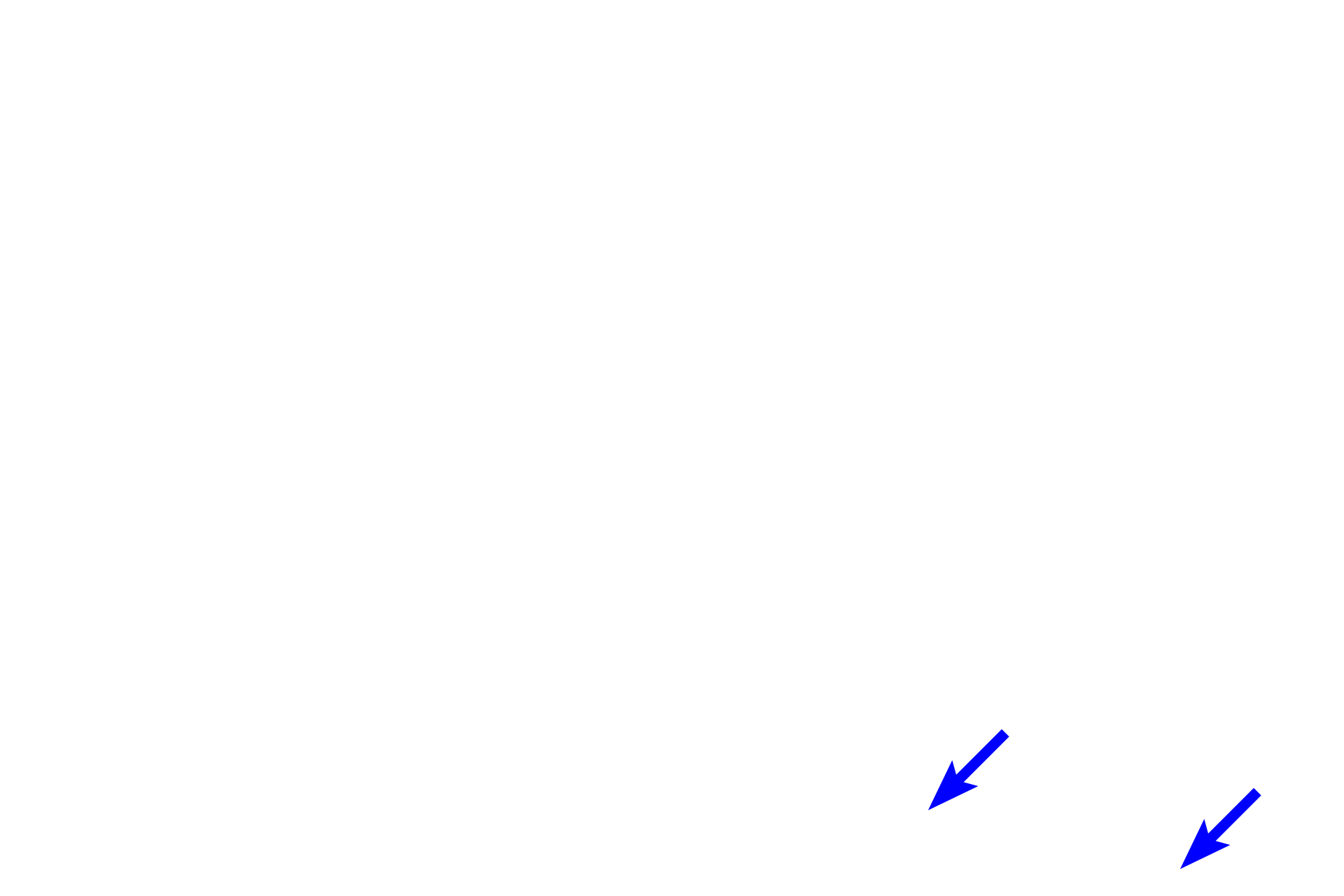 Dermis <p>Thick skin, located on the fingertips, palms and soles of the feet, has a much thicker stratum corneum.  Additionally, a stratum lucidum is present between the stratum granulosum and the stratum corneum.  The stratum lucidem is a clear layer of non-nucleated, flattened cells, and is considered a subdivision of the stratum corneum. 100x</p>
