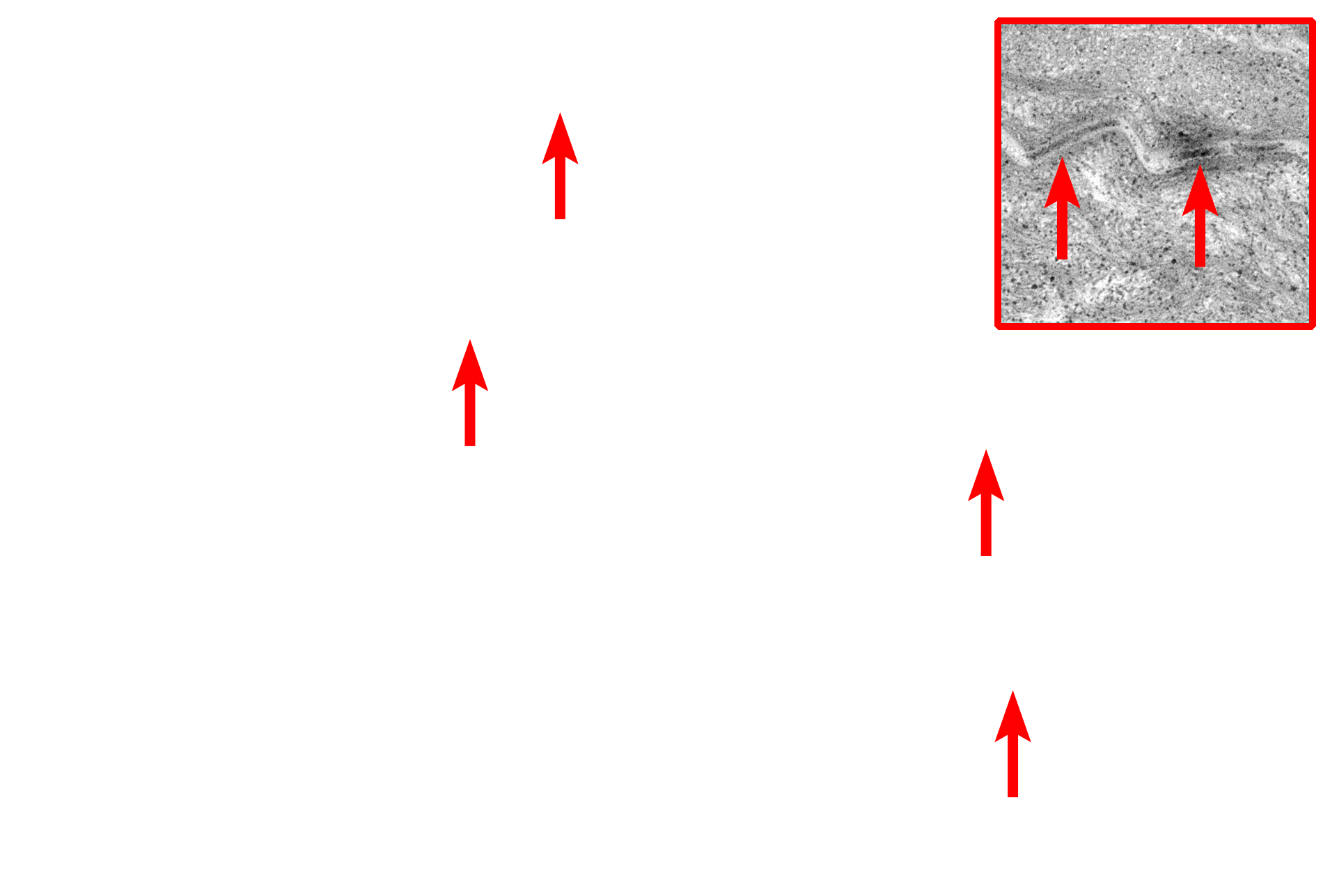 Desmosomes <p>This electron micrograph shows the outermost layers of cells of the stratum corneum with two desquamated cells at its surface.  Each keratinized cell is less than one micron thick and is filled with an amorphous matrix containing aggregated keratin filaments.  Desmosomal junctions are mostly degraded in the upper regions of the stratum corneum.  15,000x</p>
