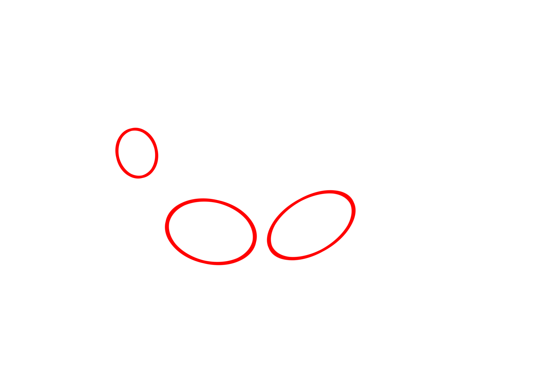  - Hemidesmosomes <p>Cells of the stratum basale rest on a basal lamina, securely anchored to it by numerous hemidesmosomes into which keratin filaments insert. The basal lamina is composed of a lamina lucida and a lamina densa, which rests, in turn, on the reticular lamina of the dermis. Fibrils from lamina densa anchor the basal lamina to the reticular lamina. The basal lamina together with the reticular lamina constitute the basement membrane.  35,000x</p>
