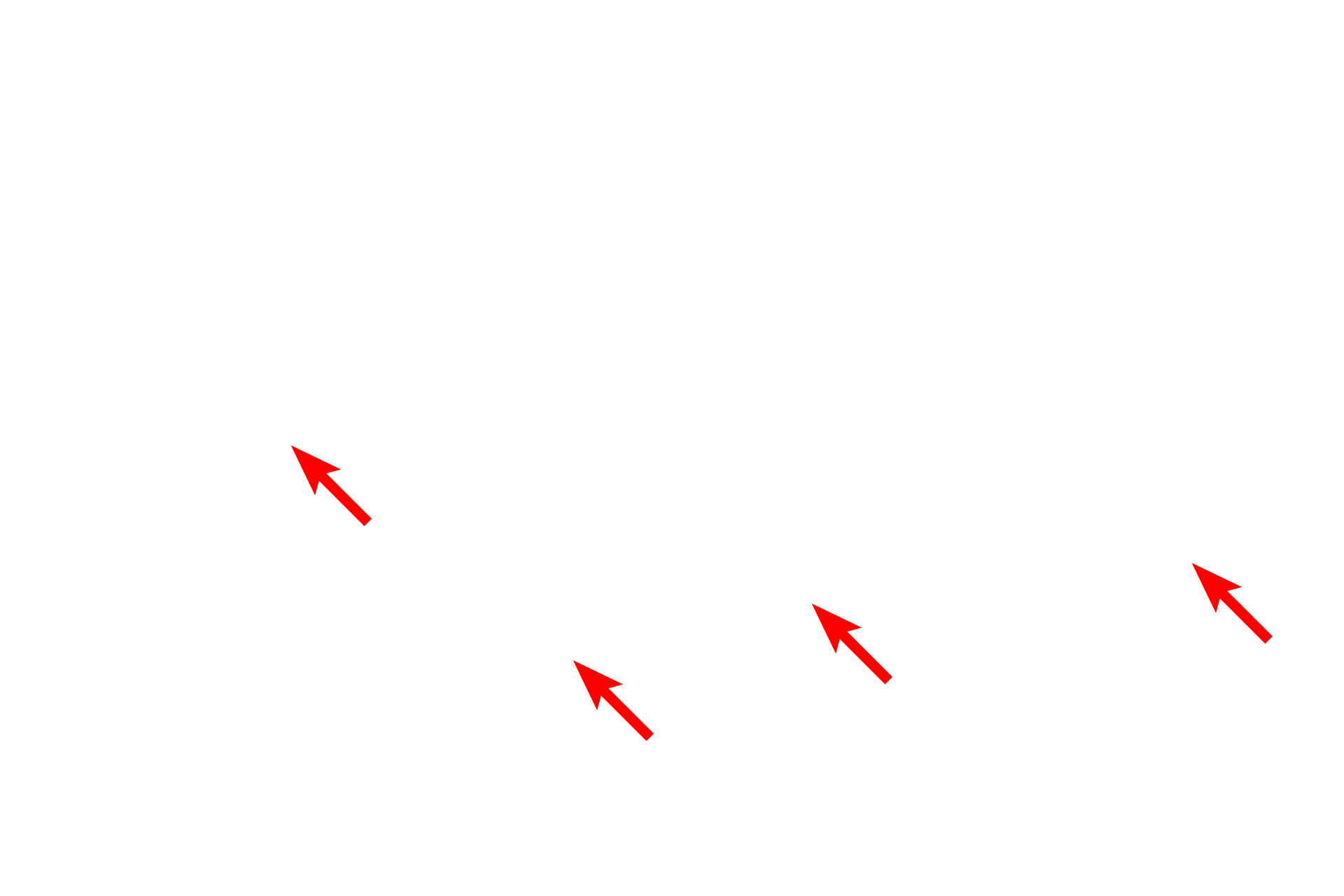  - Lamina densa <p>Cells of the stratum basale rest on a basal lamina, securely anchored to it by numerous hemidesmosomes into which keratin filaments insert. The basal lamina is composed of a lamina lucida and a lamina densa, which rests, in turn, on the reticular lamina of the dermis. Fibrils from lamina densa anchor the basal lamina to the reticular lamina. The basal lamina together with the reticular lamina constitute the basement membrane.  35,000x</p>
