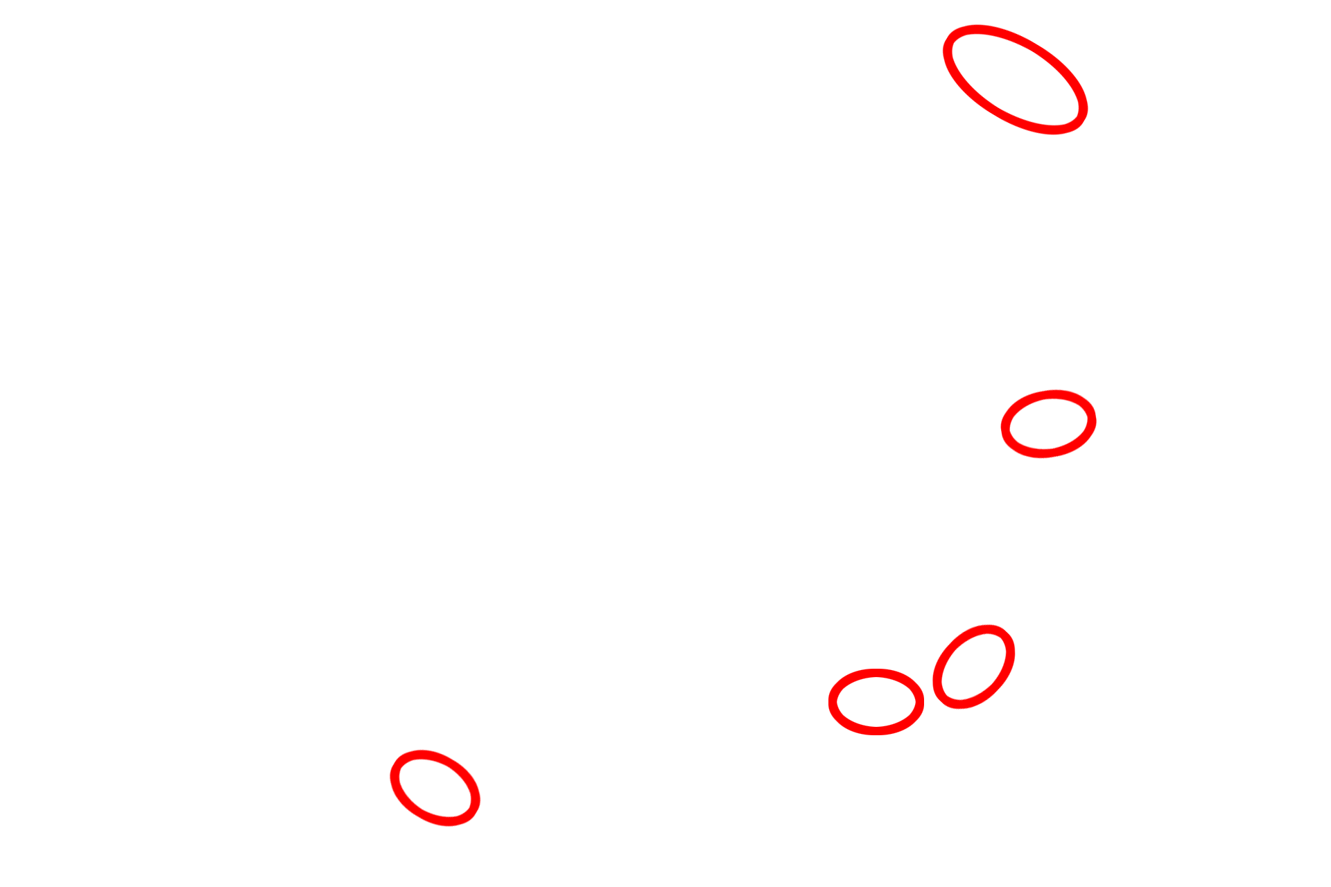 - Hemidesmosomes <p>The undulating basal surface of cells forming stratum basale is securely anchored to the basal lamina by numerous hemidesmosomes.  Converging on the hemisdesmosomes are intracellular keratin filaments (tonofilaments), which bundle into larger tonofibrils.  35,000x</p>
