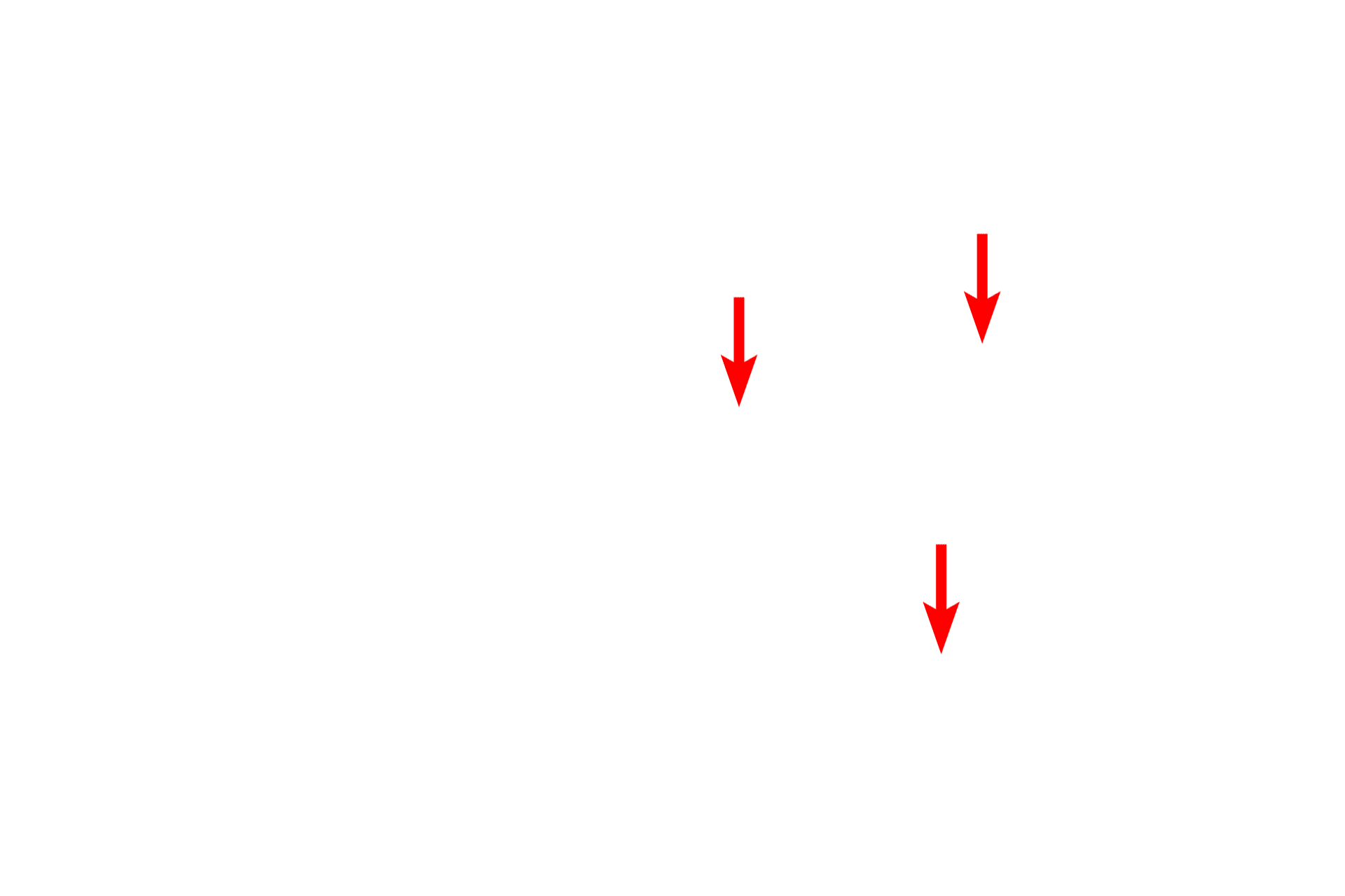  - Tonofilaments <p>The undulating basal surface of cells forming stratum basale is securely anchored to the basal lamina by numerous hemidesmosomes.  Converging on the hemisdesmosomes are intracellular keratin filaments (tonofilaments), which bundle into larger tonofibrils.  35,000x</p>
