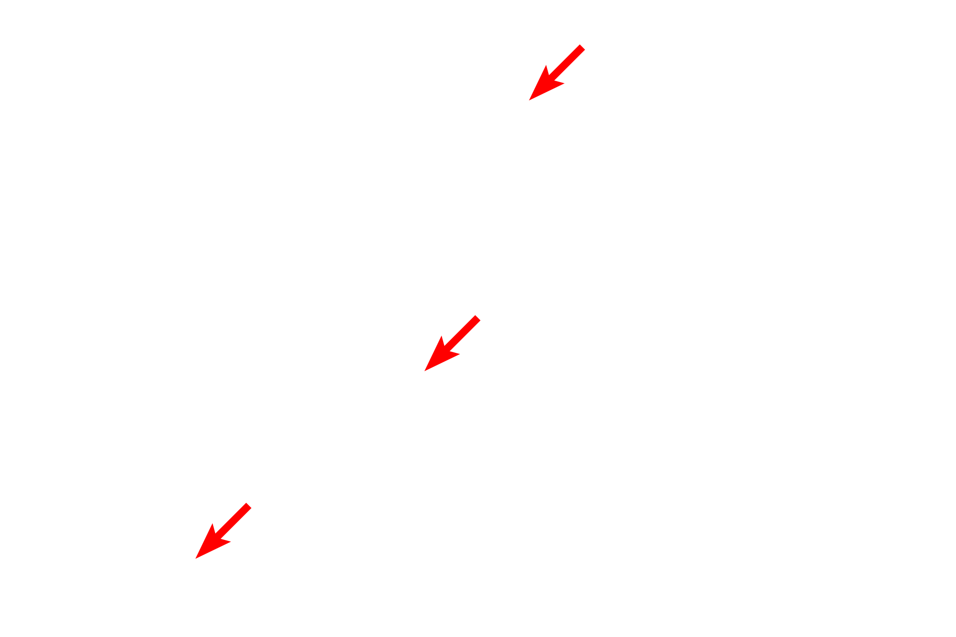  - Tonofibrils <p>The undulating basal surface of cells forming stratum basale is securely anchored to the basal lamina by numerous hemidesmosomes.  Converging on the hemisdesmosomes are intracellular keratin filaments (tonofilaments), which bundle into larger tonofibrils.  35,000x</p>

