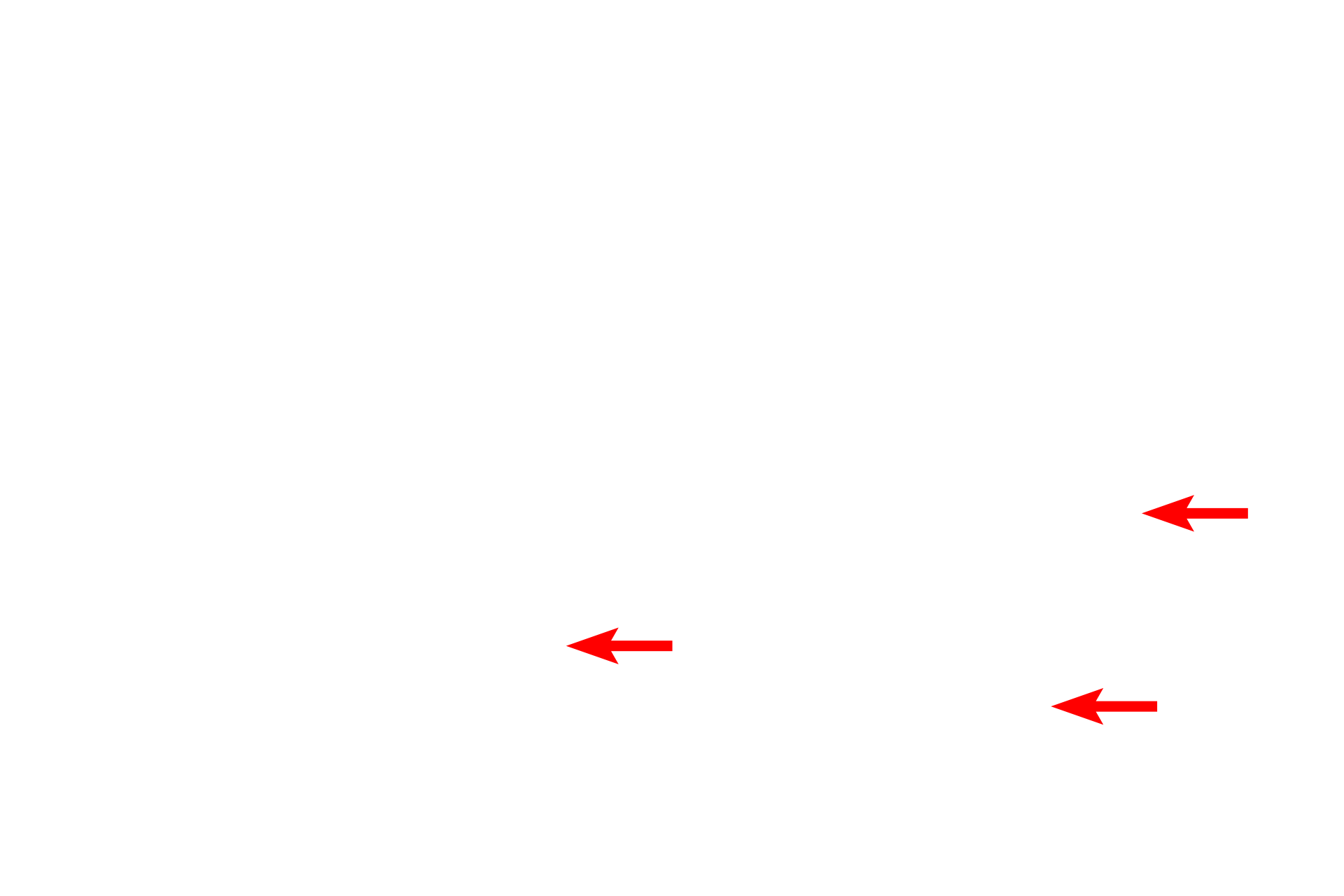  - Anchoring fibrils <p>The undulating basal surface of cells forming stratum basale is securely anchored to the basal lamina by numerous hemidesmosomes.  Converging on the hemisdesmosomes are intracellular keratin filaments (tonofilaments), which bundle into larger tonofibrils.  35,000x</p>
