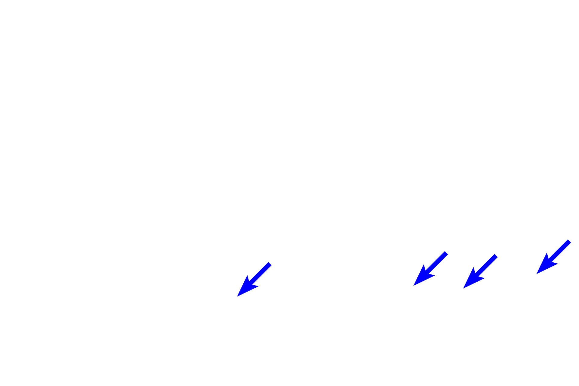 Melanocytes > <p>Melanocytes are located primarily in the stratum basale, although they can also be found in the stratum spinosum.  Melanocytes synthesize melanin pigment, which they package into melanosomes (melanin granules) that are transferred to neighboring keratinocytes.  Melanin protects nuclear DNA in keratinocytes against ultraviolet light.</p>
