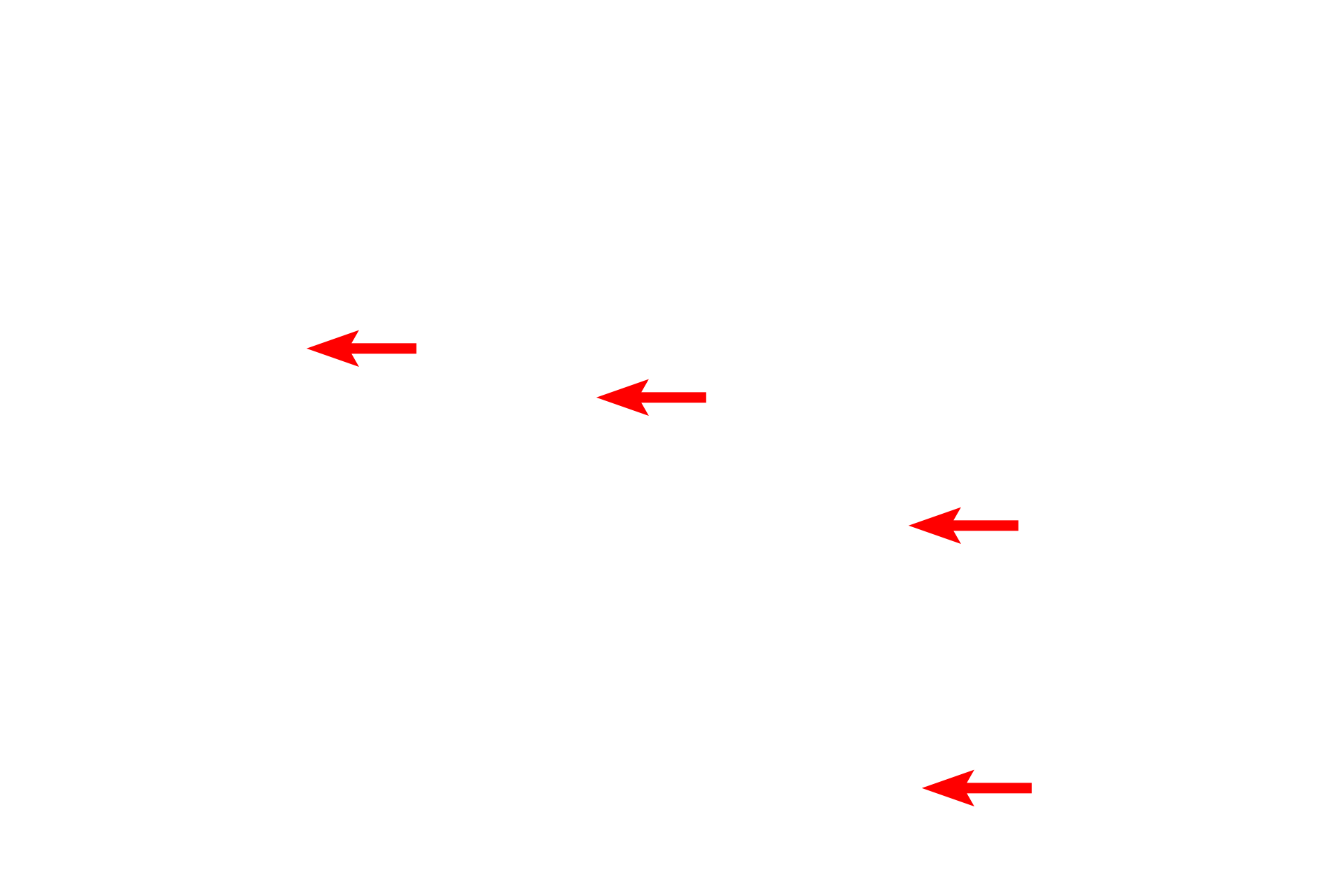  - Tonofibrils <p>This electron micrograph shows the stratum basale, consisting of a single layer of columnar cells.  The basal surfaces of these keratinocytes are highly folded for anchorage to the basal lamina.  The cells contain tonofibrils composed of tonofilaments (keratin filaments), which are mostly oriented perpendicular to the basal lamina.  4000x</p>
