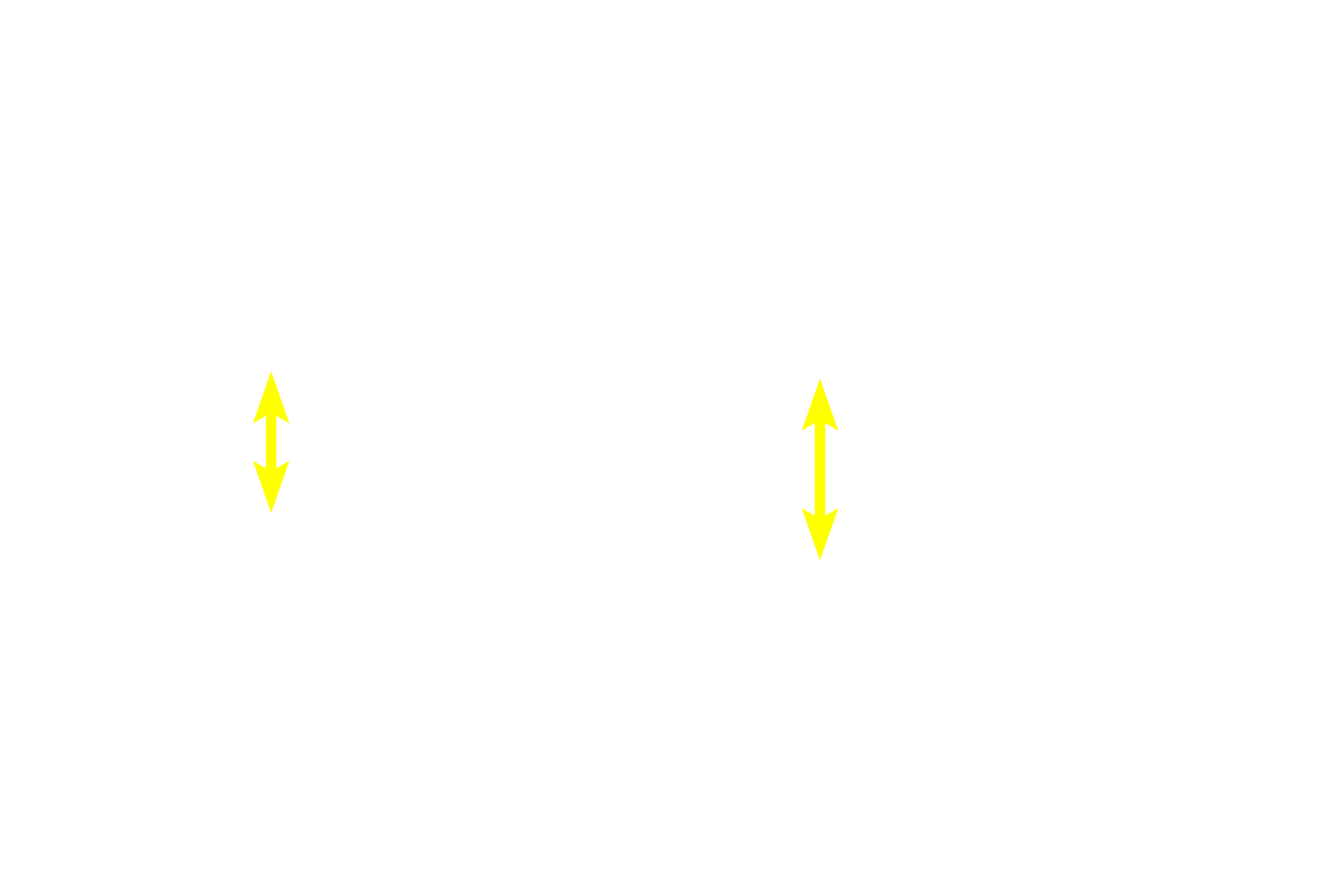 Stratum basale <p>This section shows a more highly pigmented epidermis with increased melanin in the stratum basale cells.  Melanocytes, identified by their clear cytoplasm and heterochromatic nuclei, are visible among the basal cells.  The number of melanocytes remains constant across individuals with different skin tones, however their melanin-synthesizing activity varies.  Pentachrome stain,  1000x</p>
