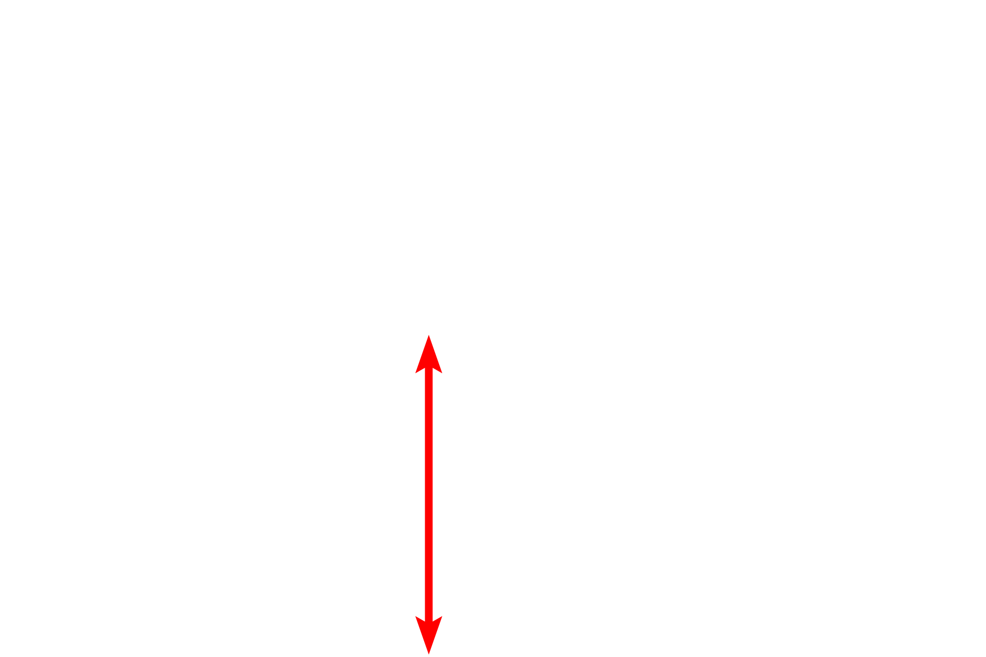 Papillary layer of dermis <p>This section shows a more highly pigmented epidermis with increased melanin in the stratum basale cells.  Melanocytes, identified by their clear cytoplasm and heterochromatic nuclei, are visible among the basal cells.  The number of melanocytes remains constant across individuals with different skin tones, however their melanin-synthesizing activity varies.  Pentachrome stain,  1000x</p>
