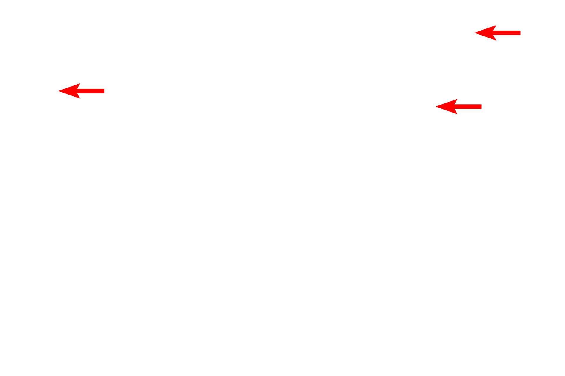  - Melanocyte processes <p>Melanocytes in stratum basale synthesize melanin pigment in vesicles called melanosomes. Once formed, these vesicles migrate into melanocyte processes and are transferred to neighboring keratinocytes. Once in keratinocytes, melanin distributes to a supranuclear location, blocking ultraviolet radiation.  10,000x</p>
