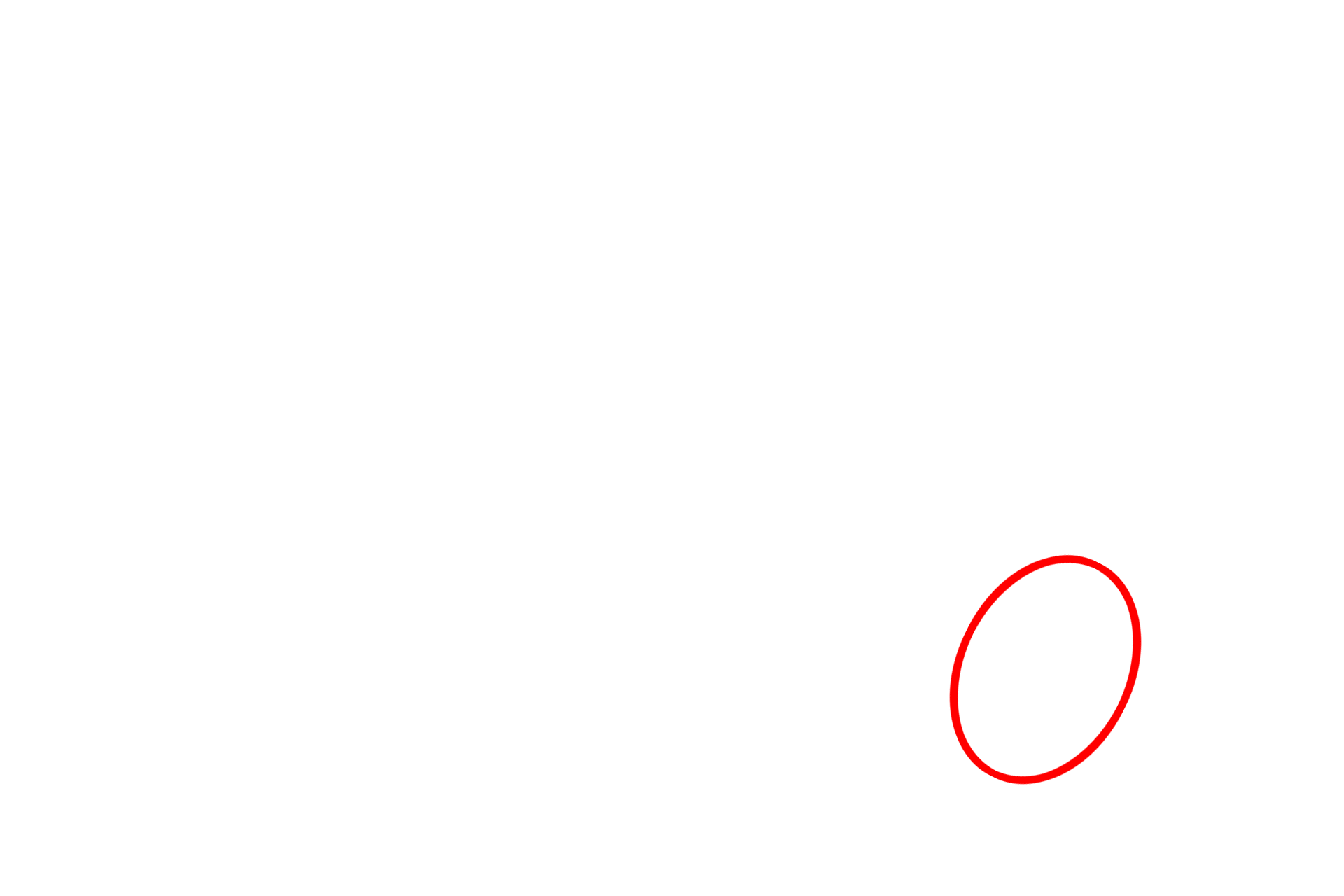 - Rough endoplasmic reticulum <p>Melanocytes in stratum basale synthesize melanin pigment in vesicles called melanosomes. Once formed, these vesicles migrate into melanocyte processes and are transferred to neighboring keratinocytes. Once in keratinocytes, melanin distributes to a supranuclear location, blocking ultraviolet radiation.  10,000x</p>
