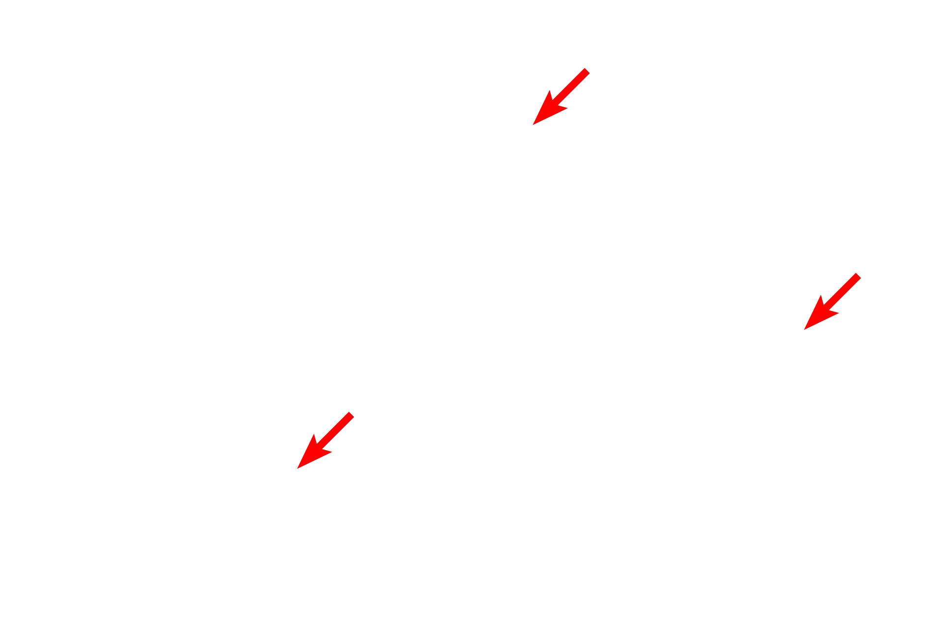  - Tonofibrils <p>Melanocytes in stratum basale synthesize melanin pigment in vesicles called melanosomes. Once formed, these vesicles migrate into melanocyte processes and are transferred to neighboring keratinocytes. Once in keratinocytes, melanin distributes to a supranuclear location, blocking ultraviolet radiation.  10,000x</p>
