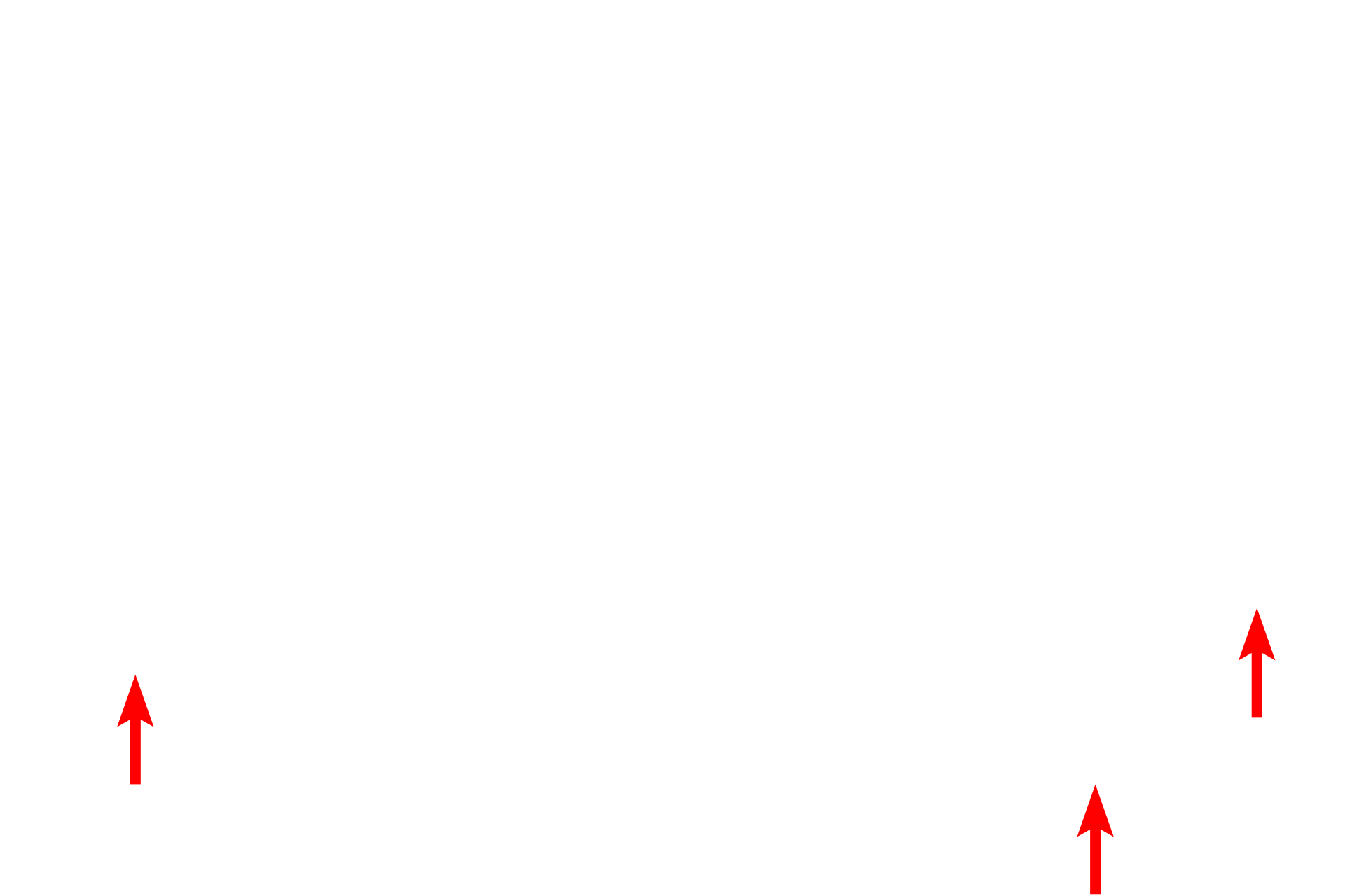 Basal lamina <p>Melanocytes in stratum basale synthesize melanin pigment in vesicles called melanosomes. Once formed, these vesicles migrate into melanocyte processes and are transferred to neighboring keratinocytes. Once in keratinocytes, melanin distributes to a supranuclear location, blocking ultraviolet radiation.  10,000x</p>
