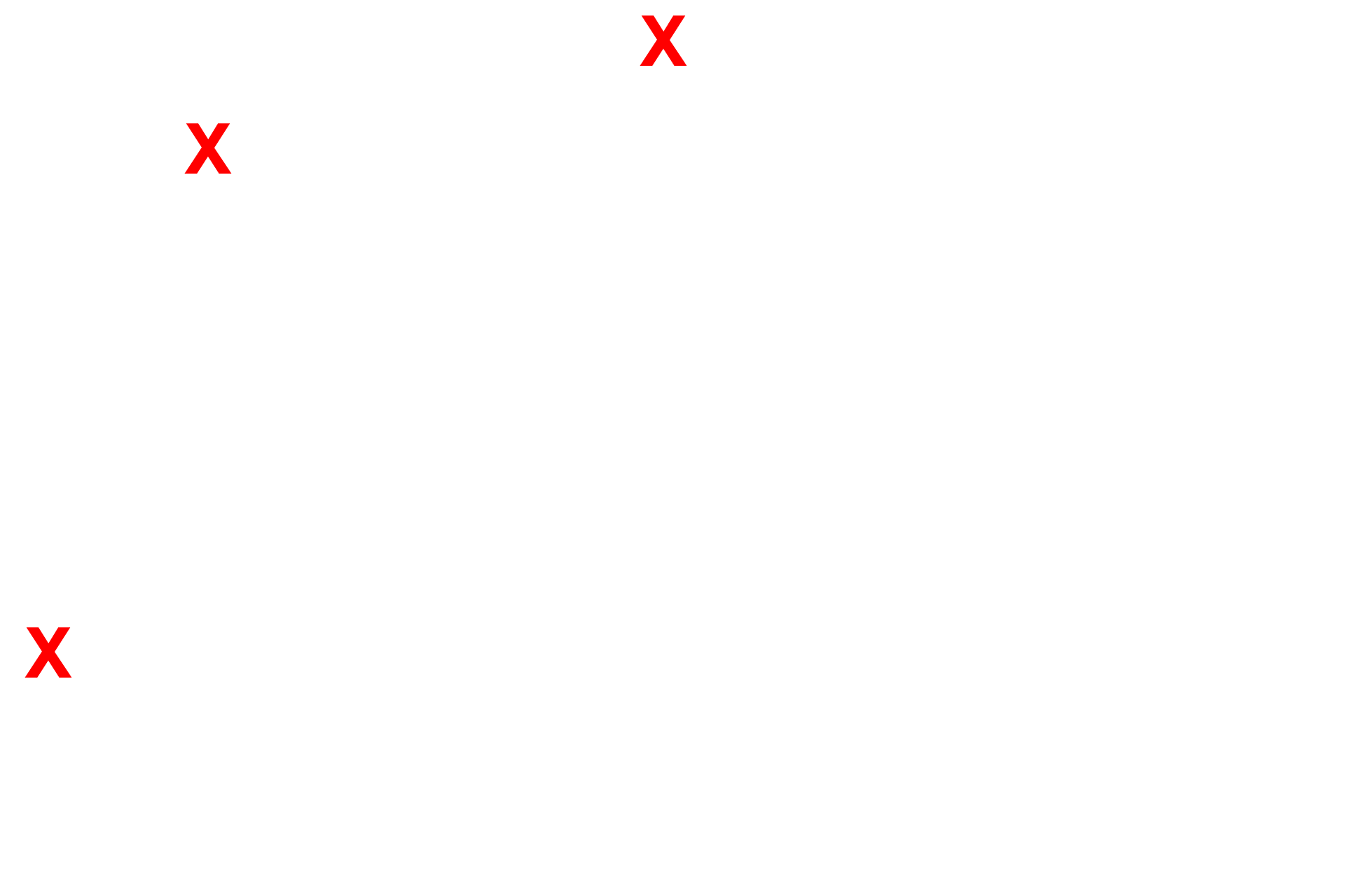 Keratinocyte <p>Pale-staining melanocytes contain melanosomes distributed throughout the cell. Melanosomes, containing the pigment melanin, are transferred into the neighboring keratinocytes. Tonofibrils, composed of keratin intermediate filaments (tonofilaments), can be seen in the keratinocytes of stratum basale.  15,000x</p>
