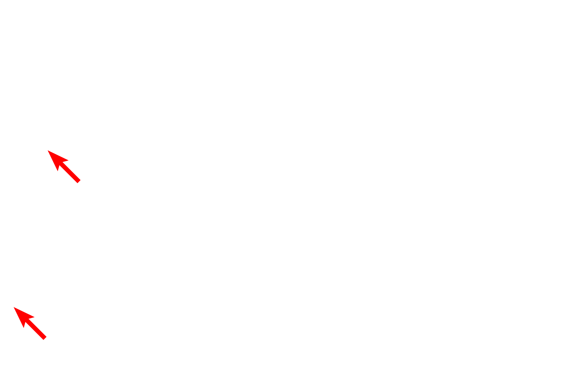  - Tonofibrils <p>Pale-staining melanocytes contain melanosomes distributed throughout the cell. Melanosomes, containing the pigment melanin, are transferred into the neighboring keratinocytes. Tonofibrils, composed of keratin intermediate filaments (tonofilaments), can be seen in the keratinocytes of stratum basale.  15,000x</p>
