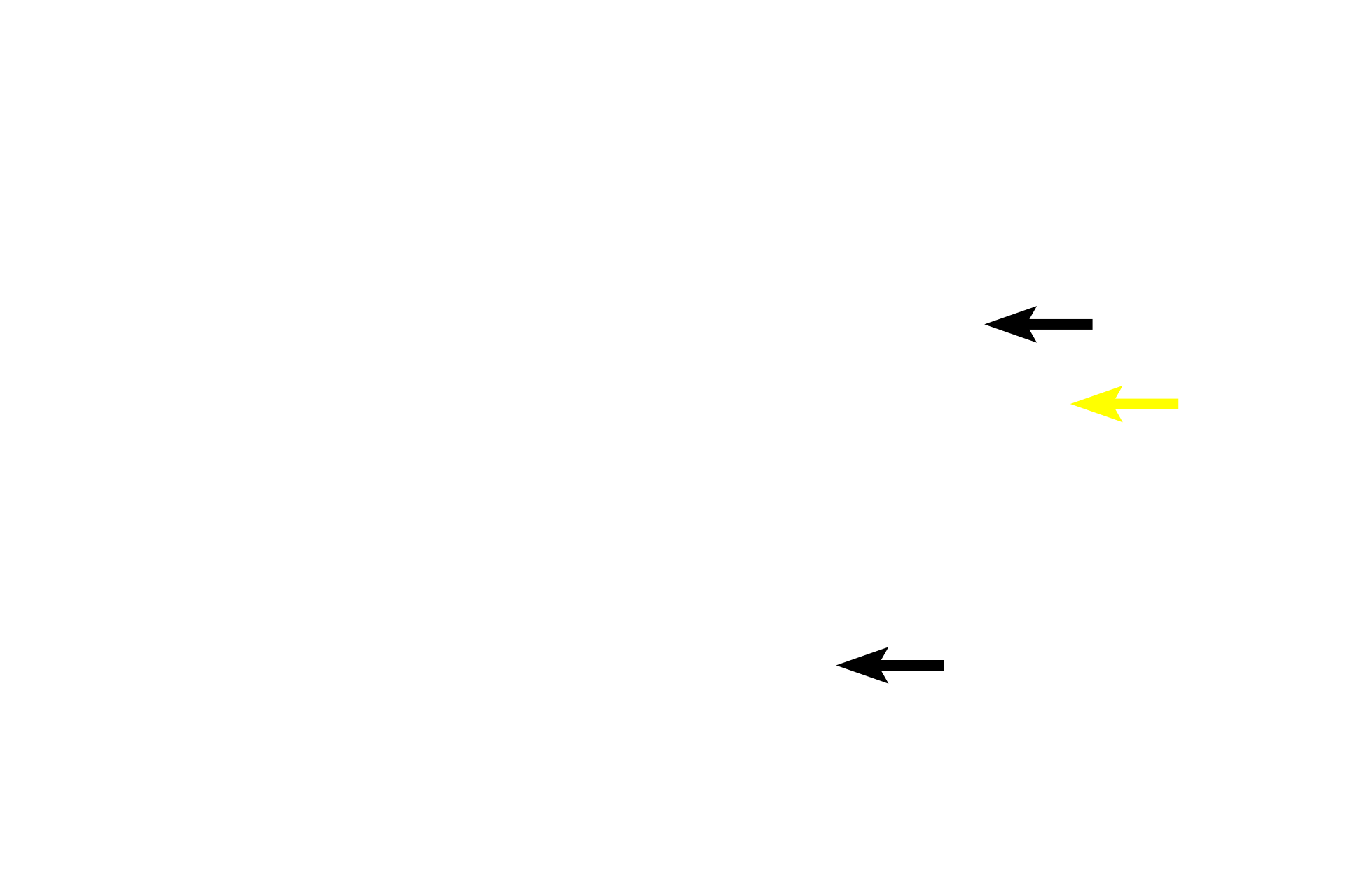 - Hair follicles > <p>Hair follicles (black arrows) are present in thin but not in thick skin. They begin deep in the dermis or in the hypodermis. Arrector pili muscles (yellow arrow), composed of smooth muscle, are attached to the hair follicle; their contraction causes the hair to become erect, bunching up the skin adjacent to the hair to form a “goose bump.”</p>
