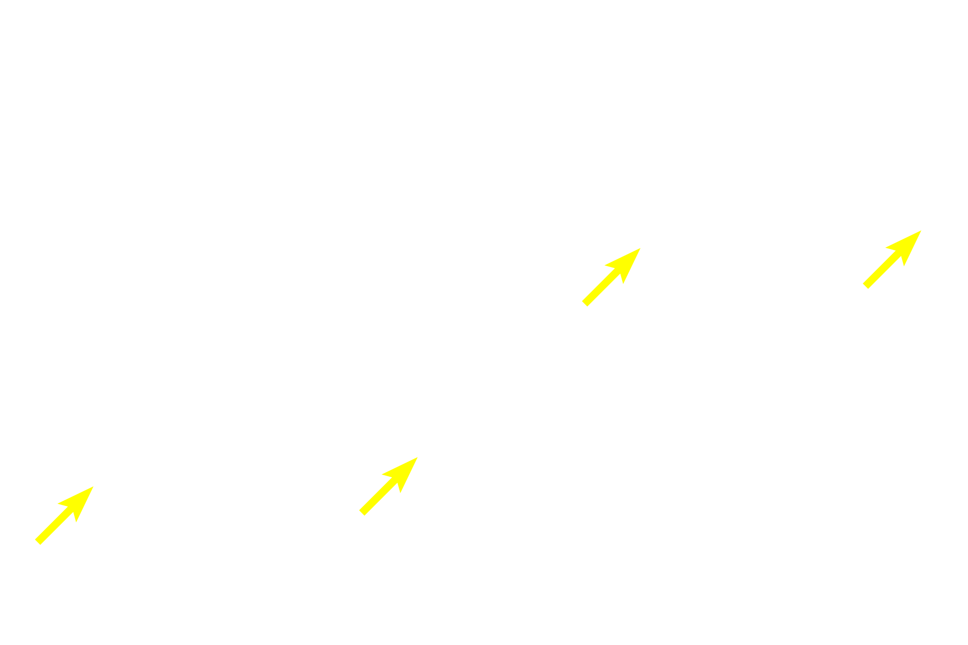 Dermal papillae <p>The interface between epidermis and dermis is strengthened by an undulating surface of downwardly extending epidermal ridges or pegs (rete ridges or pegs) that interdigitate with upwardly projecting dermal papillae. The depth of these interdigitations is greater in thick than in thin skin, reflecting the need for increased resistance against friction and stress on the palms of the hands and soles of the feet.</p>
