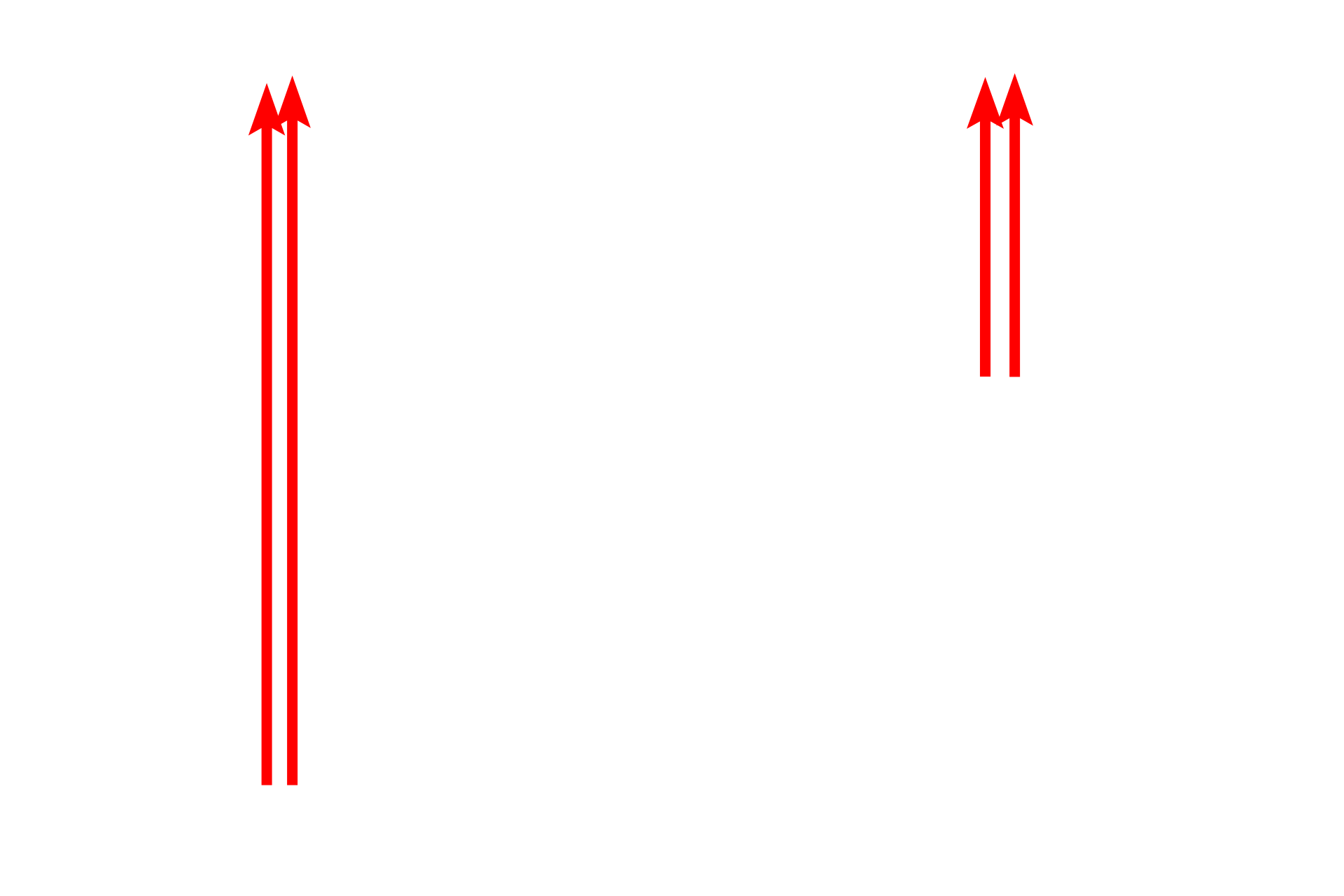 Keratinization > <p>Keratinocytes in stratum basale produce intermediate filaments (tonofilaments) composed of the protein keratin. These filaments aggregate to form tonofibrils, prominent in stratum spinosum. In stratum granulosum keratohyalin granules and tonofibrils condense to form keratin; simultaneously, organelles and nuclei are lost. The resultant, flattened, keratin-filled squames form stratum corneum.</p>
