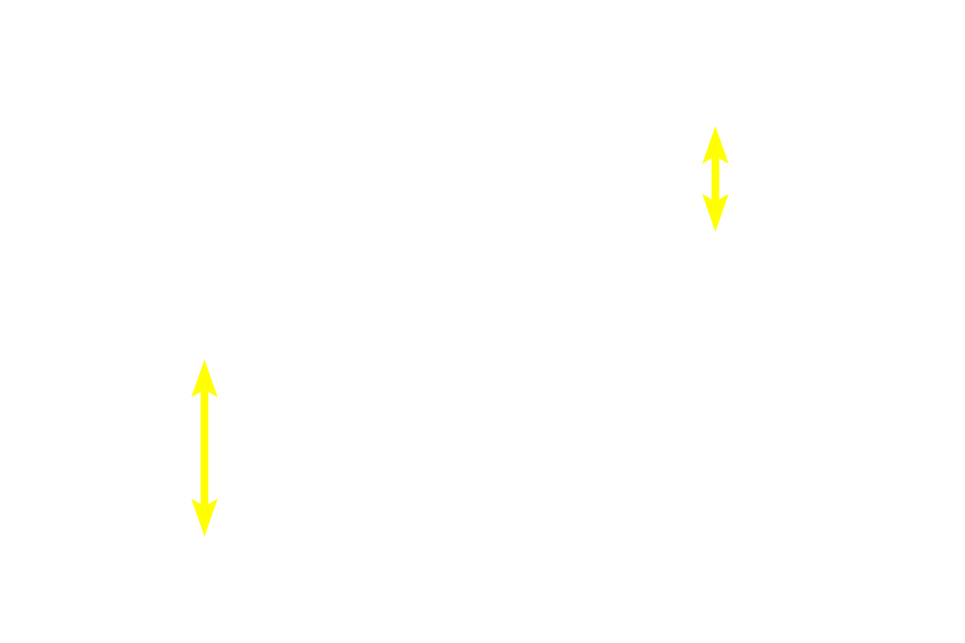 Stratum spinosum > <p>Stratum spinosum possesses 3-10 layers of keratinocytes, the deepest of which also show mitotic activity.  Cells in this layer are joined by numerous desmosomes, creating the appearance of spiny processes around their entire peripheries.  The number of layers of stratum spinosum is greatly reduced in thin skin compared to thick skin.</p>
