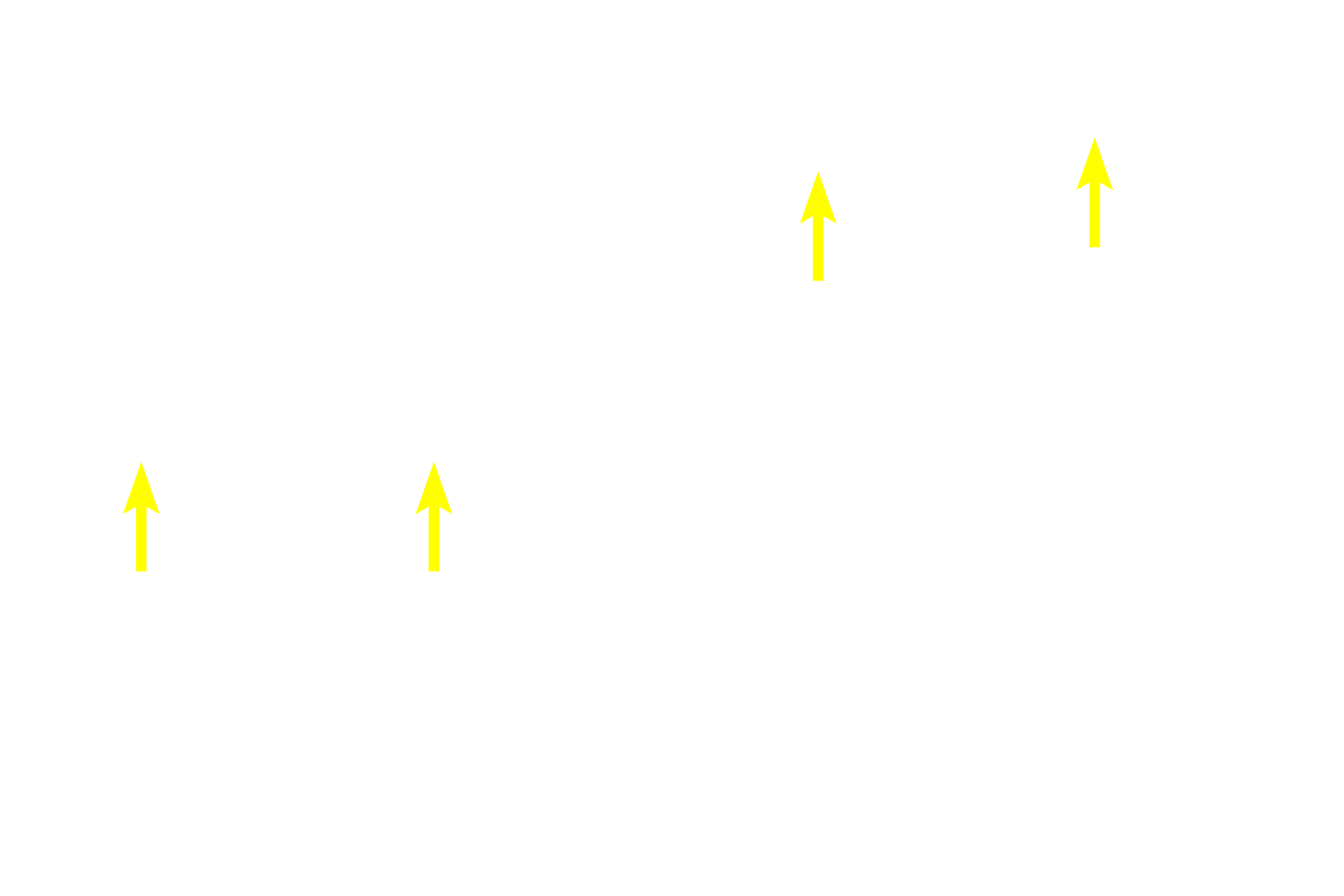 Stratum granulosum > <p>Stratum granulosum consists of three to five cell layers in thick skin and only one or two layers in thin skin.  The prominent, basophilic granules present in these keratinocytes contribute to the formation of keratin.</p>
