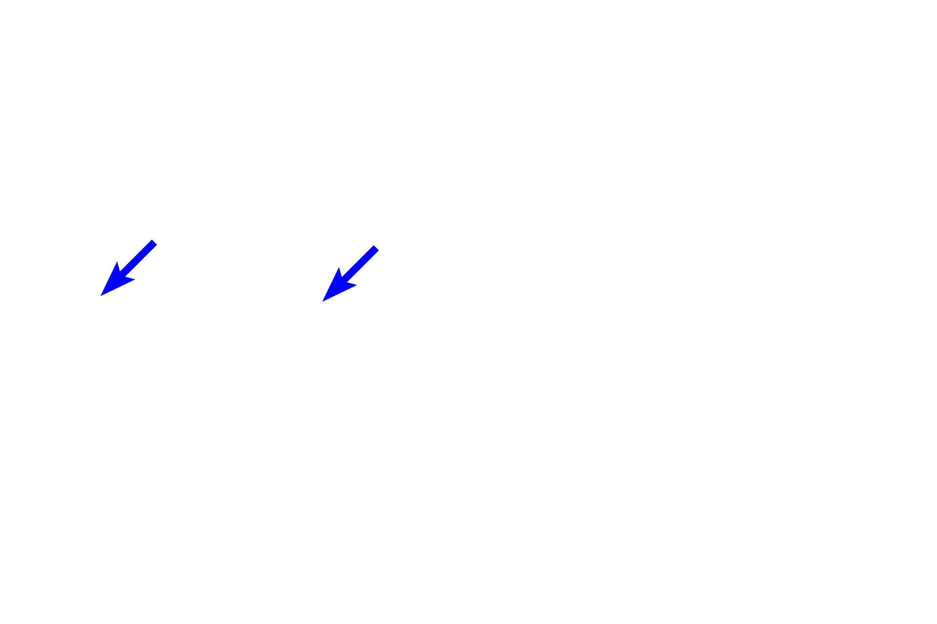 Stratum lucidum > <p>Stratum lucidum is a thin translucent layer that is visible only in thick skin on the palms and soles of the feet.  It is not present as a distinct layer elsewhere and is often considered to be a subdivision of the stratum corneum.  The stratum lucidum lacks cell nuclei and organelles.</p>
