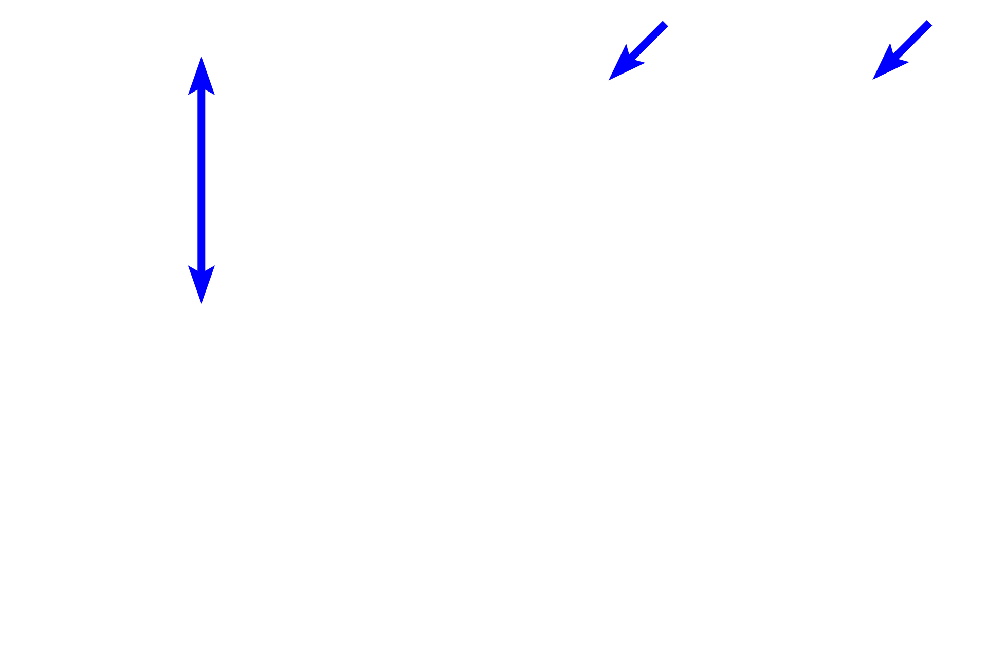 Stratum corneum > <p>Stratum corneum represents the flattened squames of keratinocytes that are entirely filled with the scleroprotein, keratin.  Stratum corneum is quite thick in thick skin but is greatly reduced in thin skin.</p>

