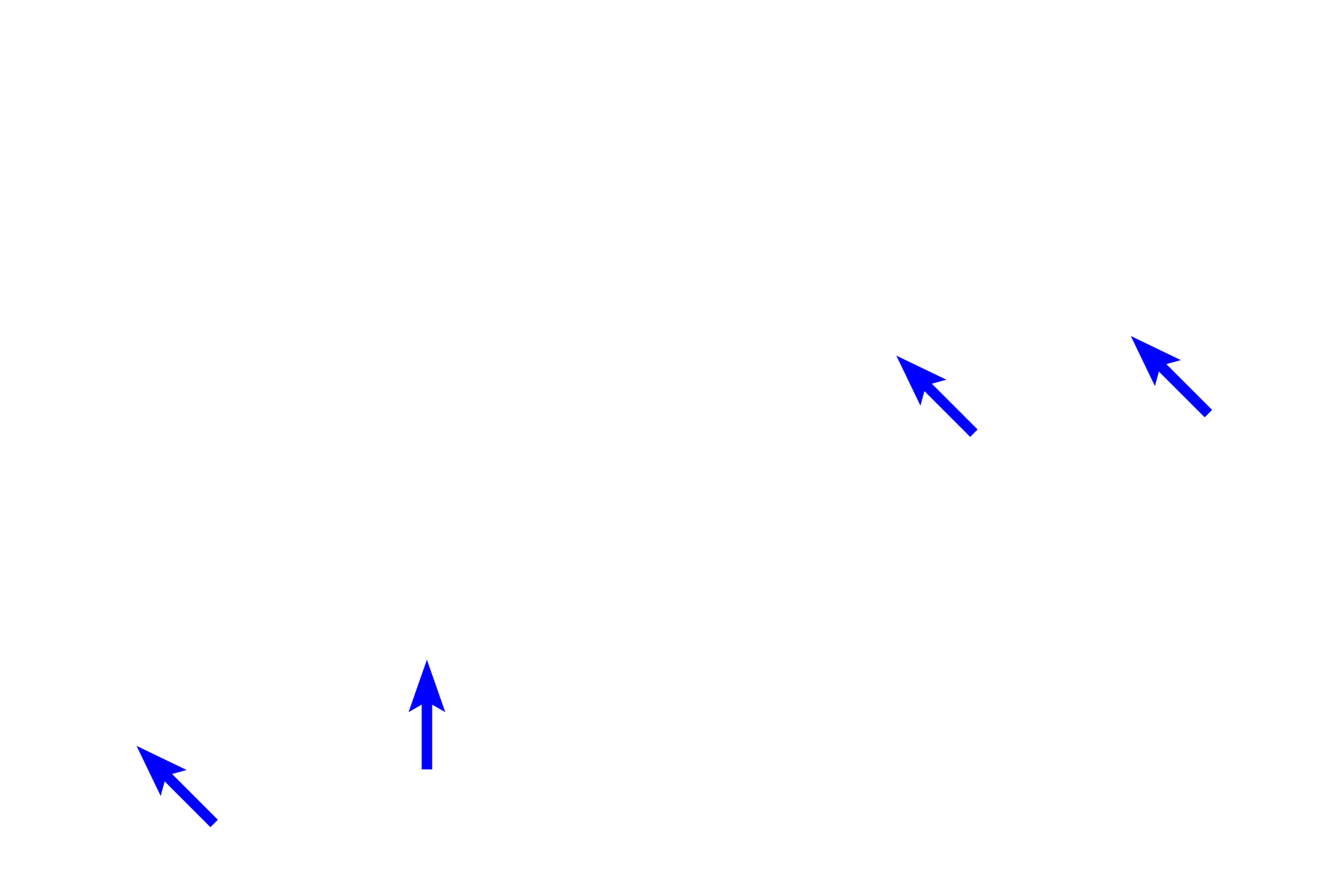  - Papillary layer of dermis <p>The dermis, lying beneath the epidermis, consists of two layers. Immediately beneath the epidermis is the papillary layer, composed of loose connective tissue.  Beneath that is the reticular layer, composed of dense irregular connective tissue. These two layers blend at their junction, with no distinct demarcation between the two layers.</p>
