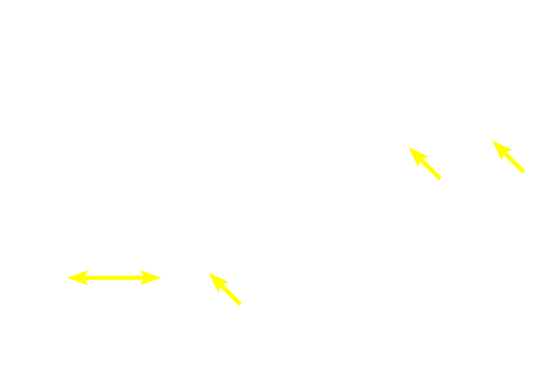 Epidermal ridges (pegs) > <p>The interface between epidermis and dermis is strengthened by an undulating surface of downwardly extending epidermal ridges or pegs (rete ridges or pegs) that interdigitate with upwardly projecting dermal papillae. The depth of these interdigitations is greater in thick than in thin skin, reflecting the need for increased resistance against friction and stress on the palms of the hands and soles of the feet.</p>
