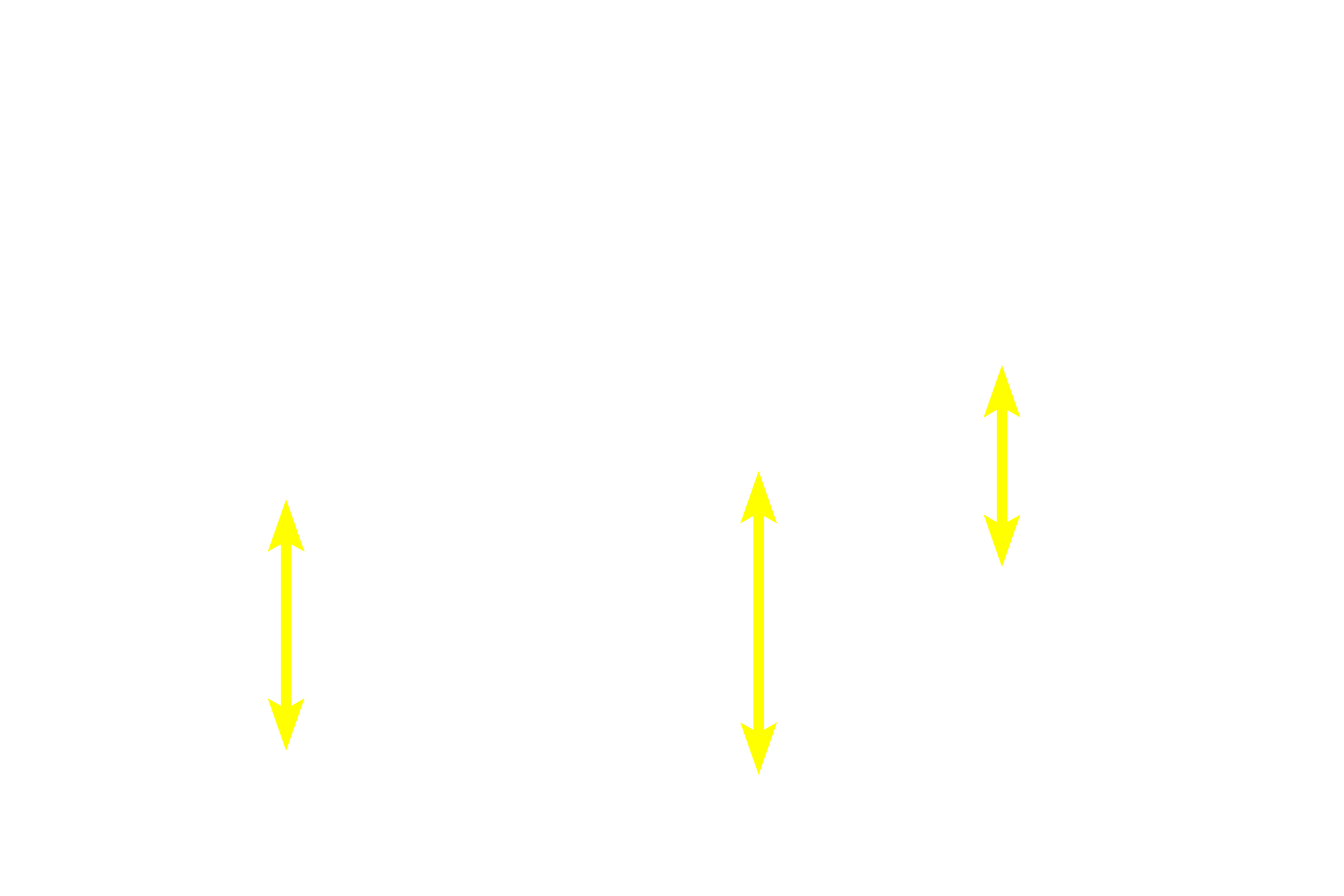  - Stratum spinosum <p>Skin can be classified as either thick or thin, depending on the thickness of the epidermal layer.  This image compares a diagrammatic representation of thick skin with a photomicrograph of a hematoxylin and eosin-stained section of primate skin.  200x</p>
