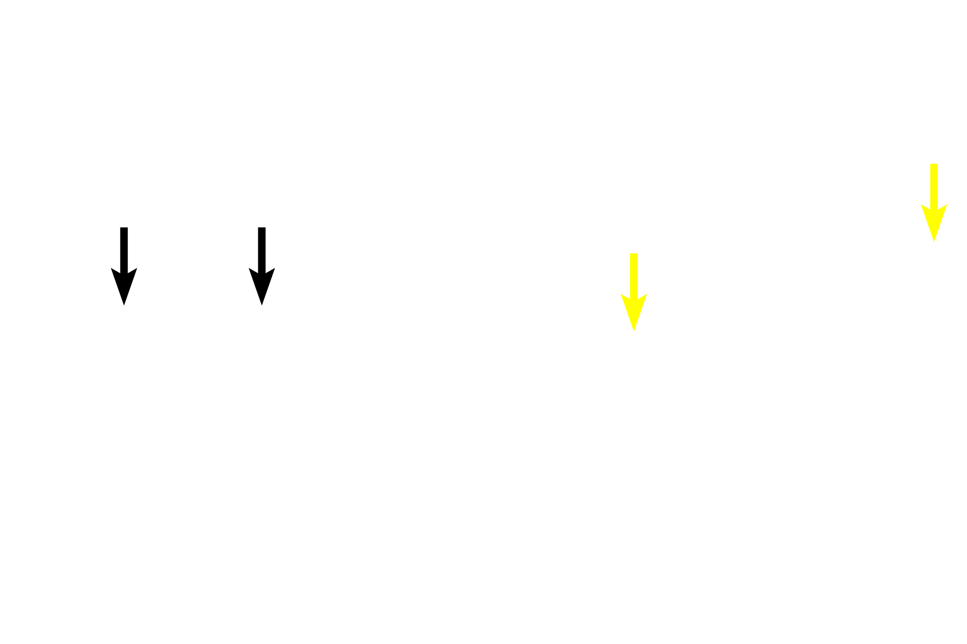  - Stratum lucidum <p>Skin can be classified as either thick or thin, depending on the thickness of the epidermal layer.  This image compares a diagrammatic representation of thick skin with a photomicrograph of a hematoxylin and eosin-stained section of primate skin.  200x</p>
