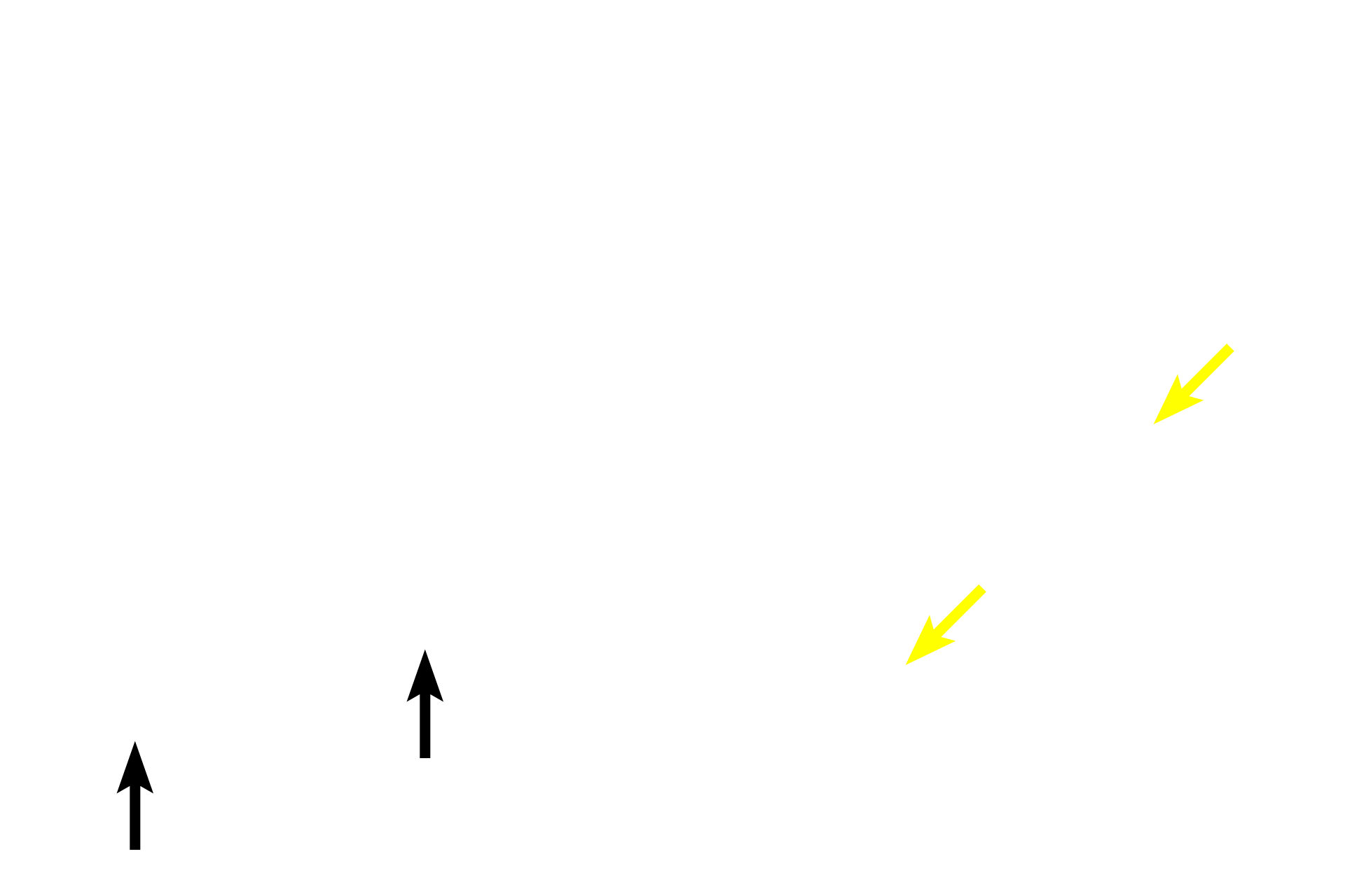  - Papillary layer of dermis <p>Skin can be classified as either thick or thin, depending on the thickness of the epidermal layer.  This image compares a diagrammatic representation of thick skin with a photomicrograph of a hematoxylin and eosin-stained section of primate skin.  200x</p>

