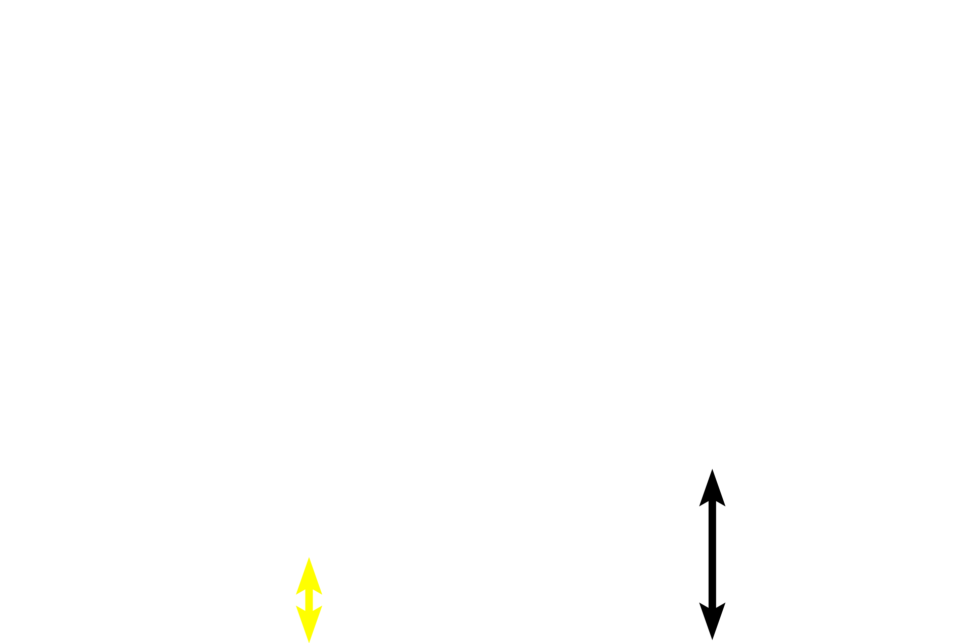  - Reticular layer of dermis <p>Skin can be classified as either thick or thin, depending on the thickness of the epidermal layer.  This image compares a diagrammatic representation of thick skin with a photomicrograph of a hematoxylin and eosin-stained section of primate skin.  200x</p>
