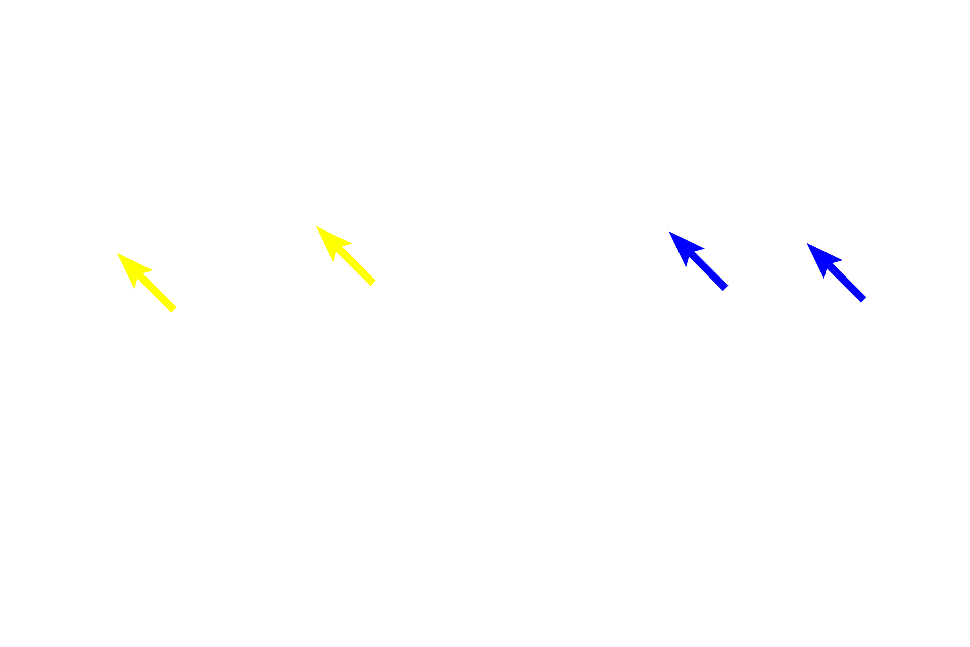  - Stratum basale <p>Skin can be classified as either thick or thin, depending on the thickness of the epidermal layer.  A diagrammatic representation of thin skin and a photomicrograph of a H&E stained section illustrate the reduced thickness of the strata in thin skin and the absence of stratum lucidum as a distinct layer.  400x</p>
