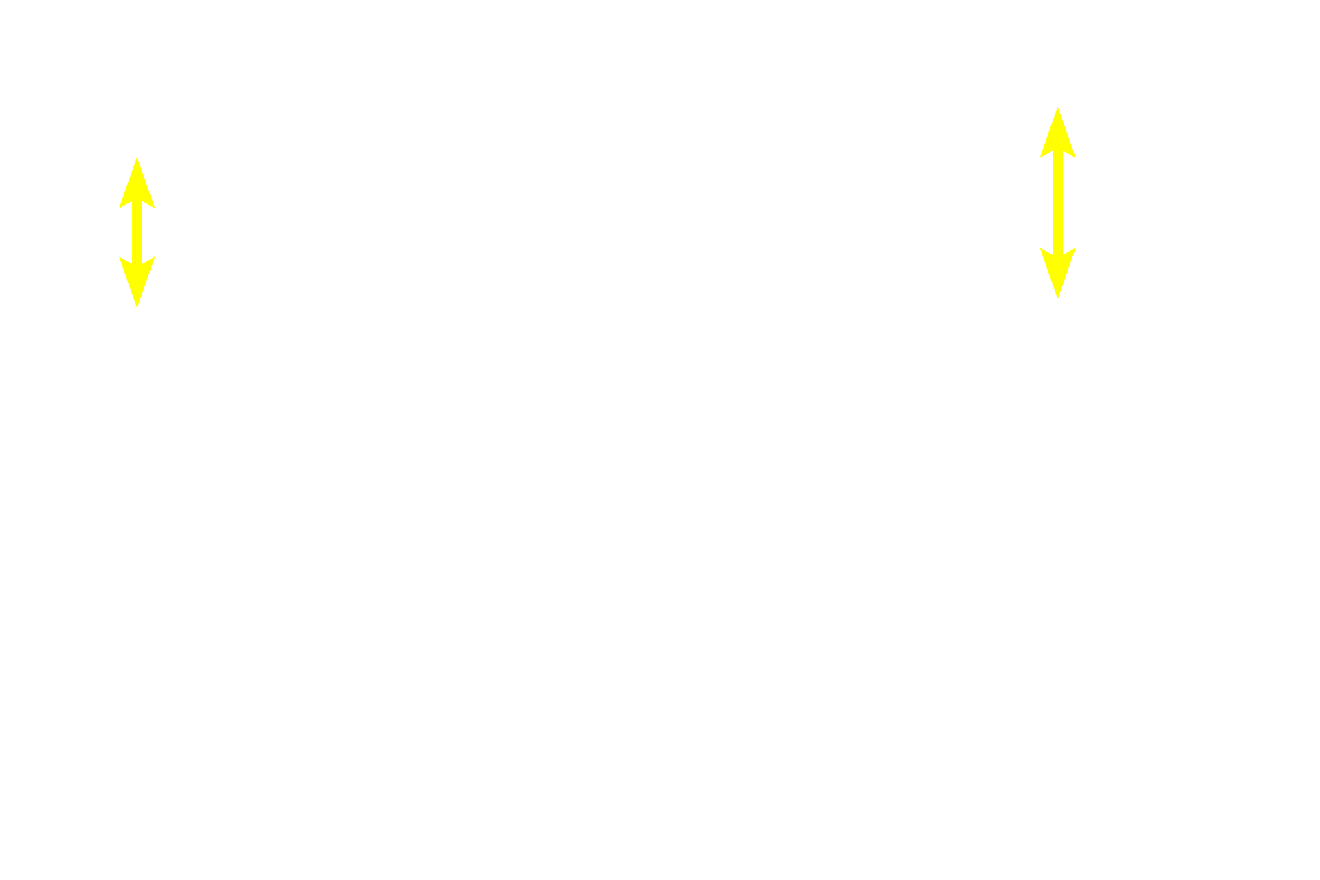  - Stratum spinosum <p>Skin can be classified as either thick or thin, depending on the thickness of the epidermal layer.  A diagrammatic representation of thin skin and a photomicrograph of a H&E stained section illustrate the reduced thickness of the strata in thin skin and the absence of stratum lucidum as a distinct layer.  400x</p>
