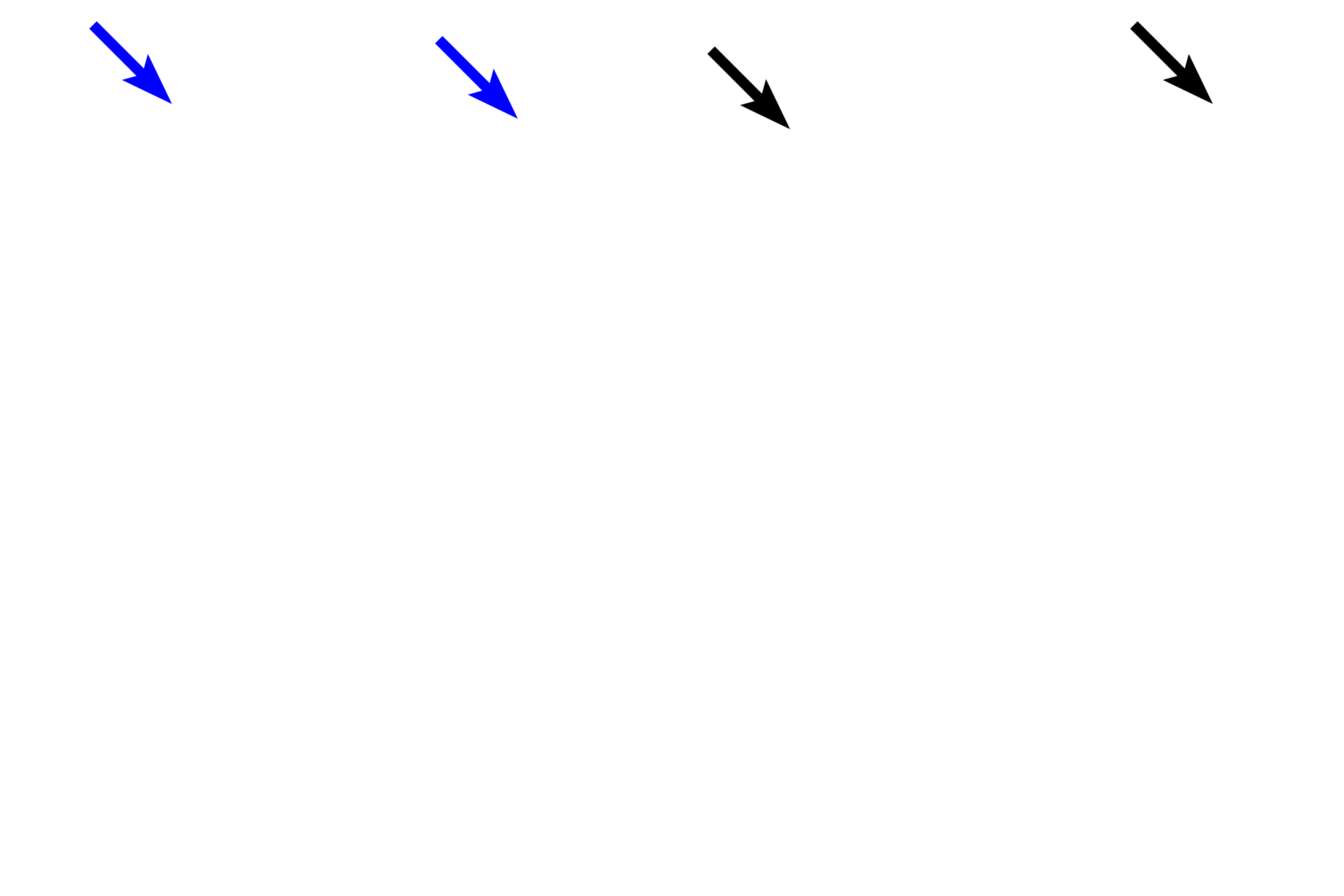  - Stratum corneum <p>Skin can be classified as either thick or thin, depending on the thickness of the epidermal layer.  A diagrammatic representation of thin skin and a photomicrograph of a H&E stained section illustrate the reduced thickness of the strata in thin skin and the absence of stratum lucidum as a distinct layer.  400x</p>
